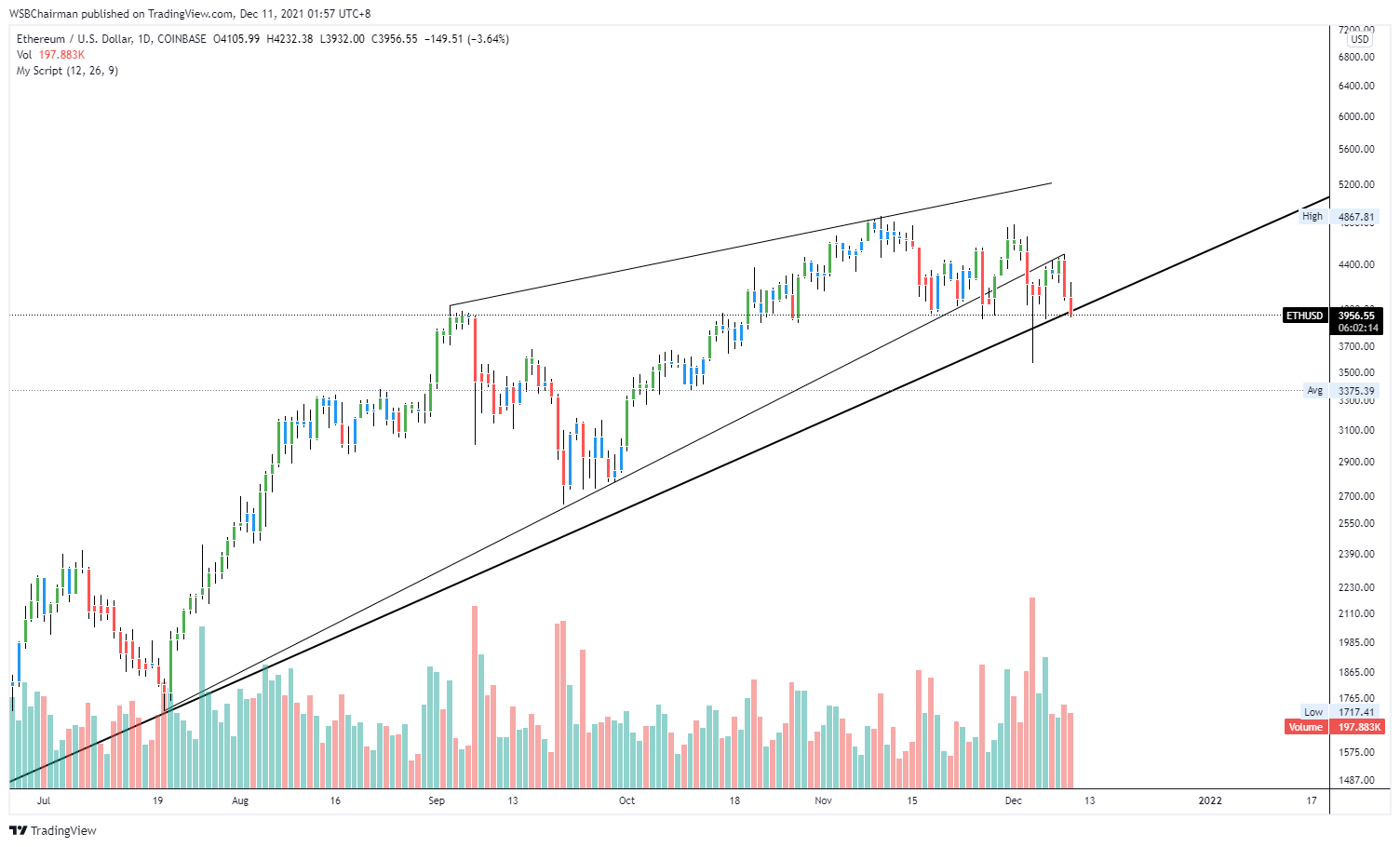COINBASE:ETHUSD Chart Image by WSBChairman