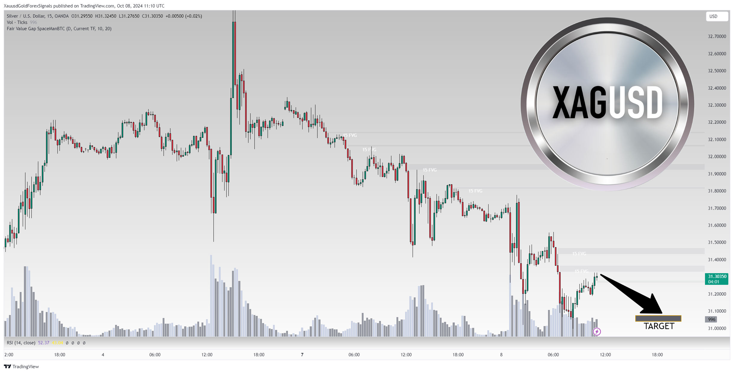 OANDA:XAGUSD Chart Image by XauusdGoldForexSignals