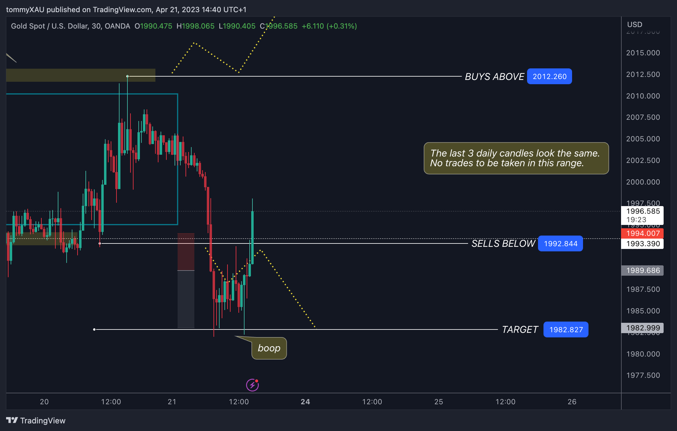 OANDA:XAUUSD Chart Image by tommyXAU