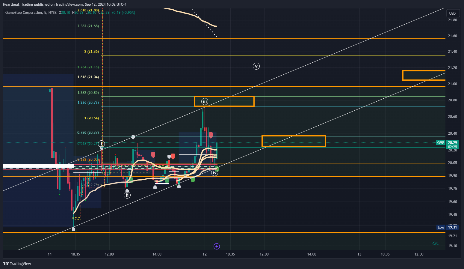 BATS:GME Chart Image by Heartbeat_Trading