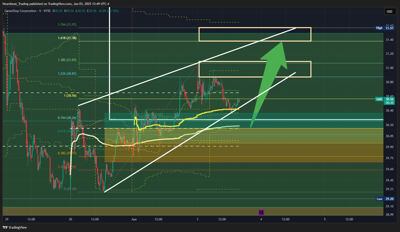 BATS:GME Chart Image by Heartbeat_Trading