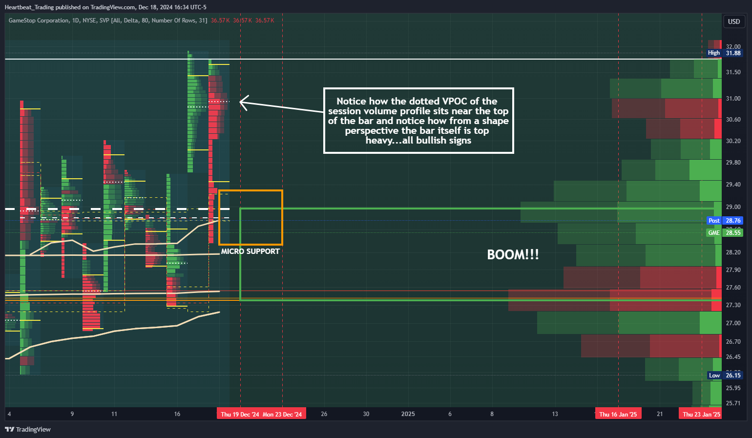 BATS:GME Chart Image by Heartbeat_Trading