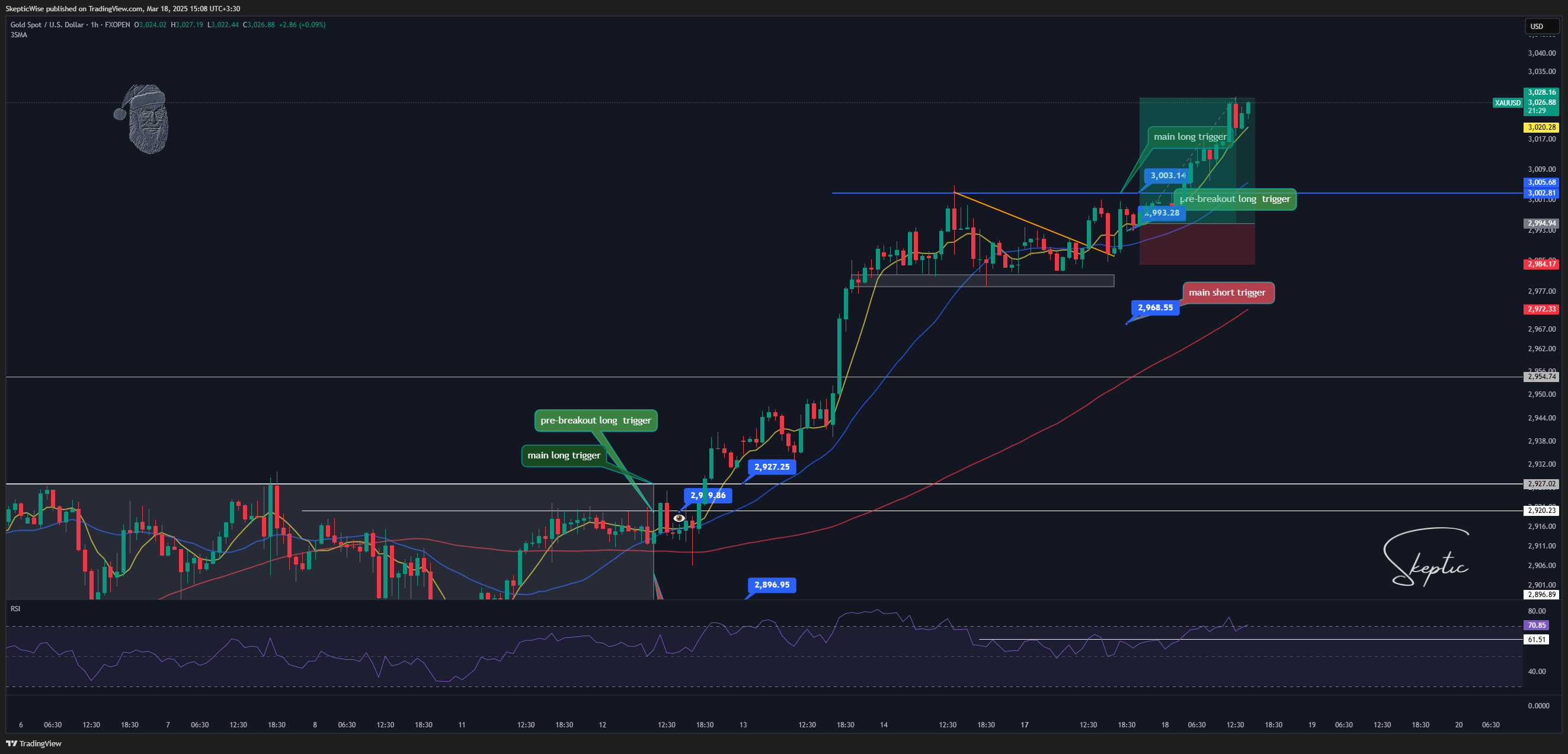FXOPEN:XAUUSD Chart Image by SkepticWise