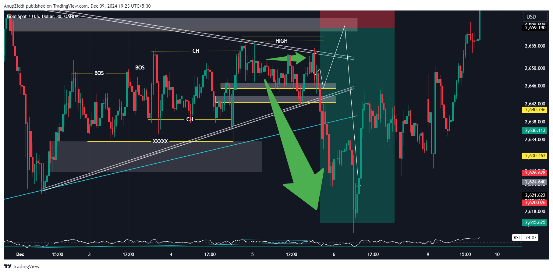 OANDA:XAUUSD Chart Image by AnupZiddi