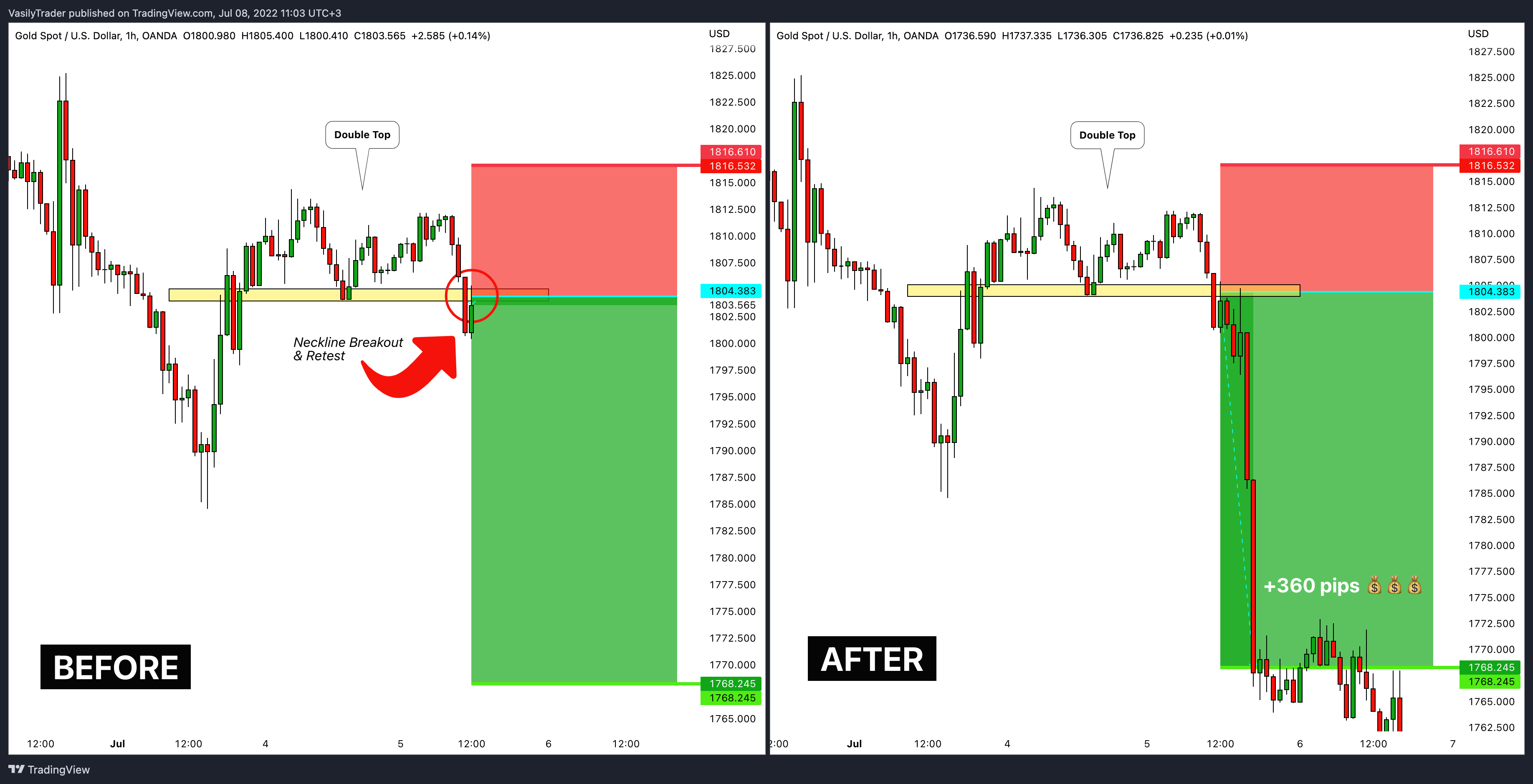 OANDA:XAUUSD Chart Image by VasilyTrader
