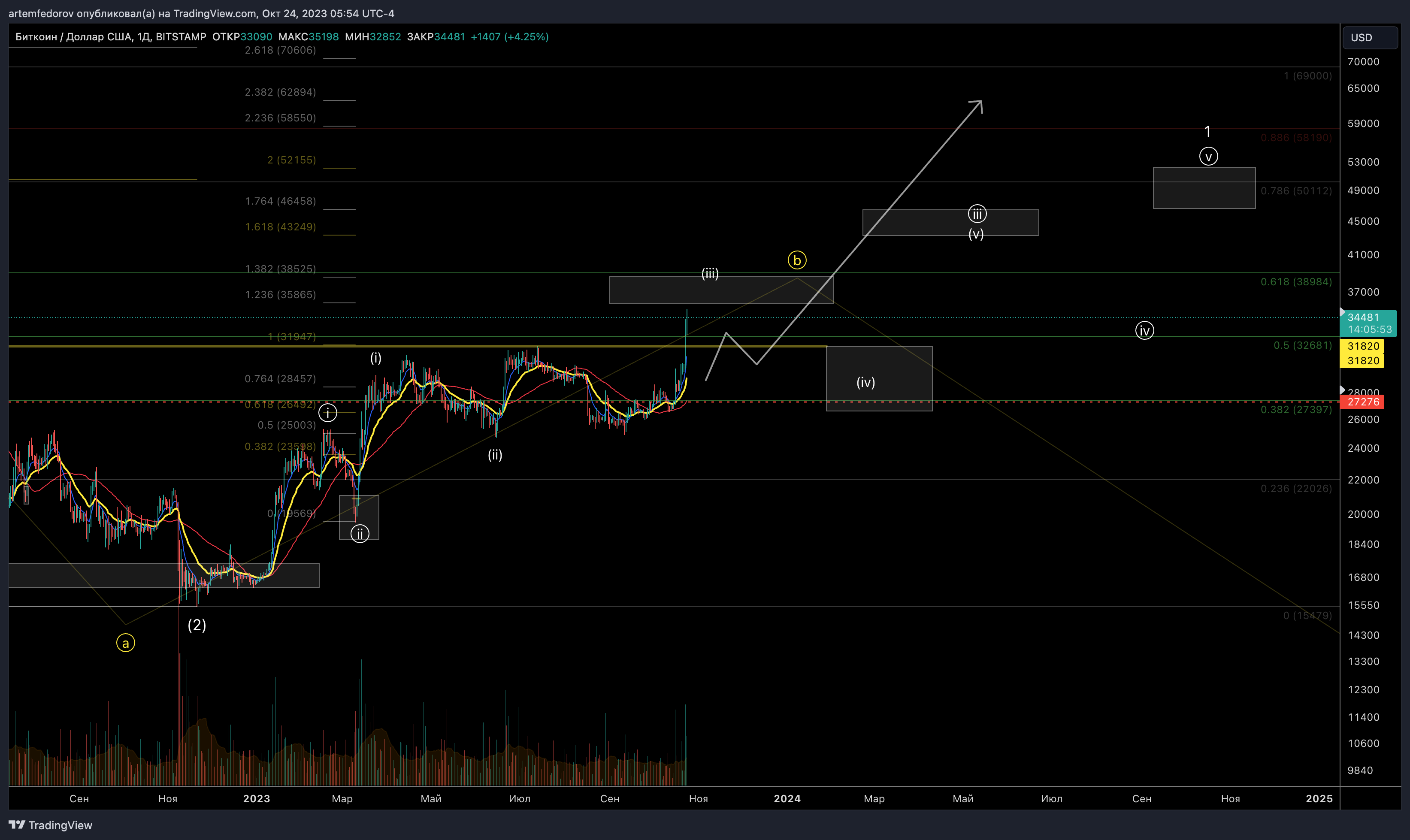 BITSTAMP:BTCUSD Chart Image by artemfedorov