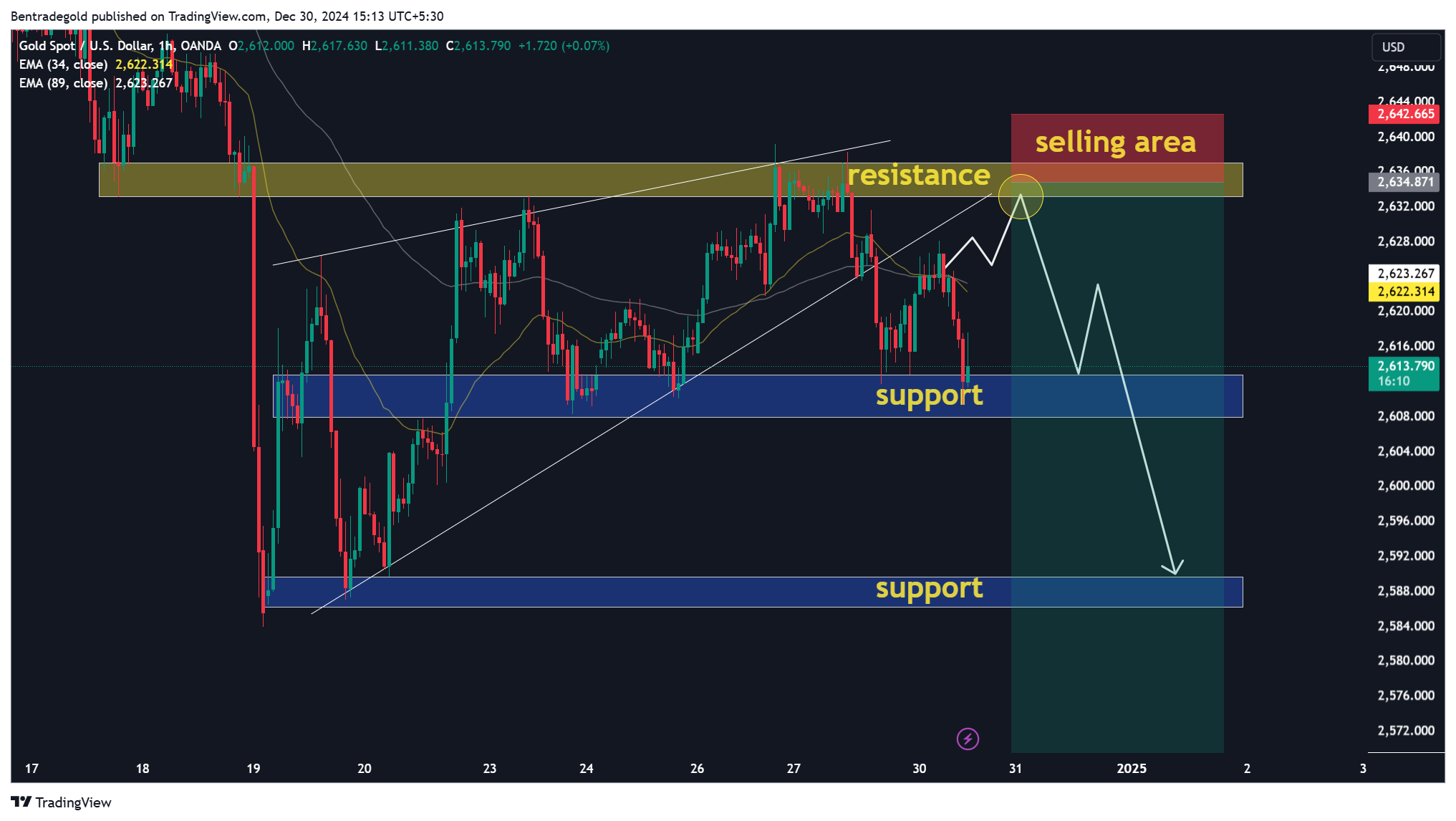 OANDA:XAUUSD Chart Image by Bentradegold