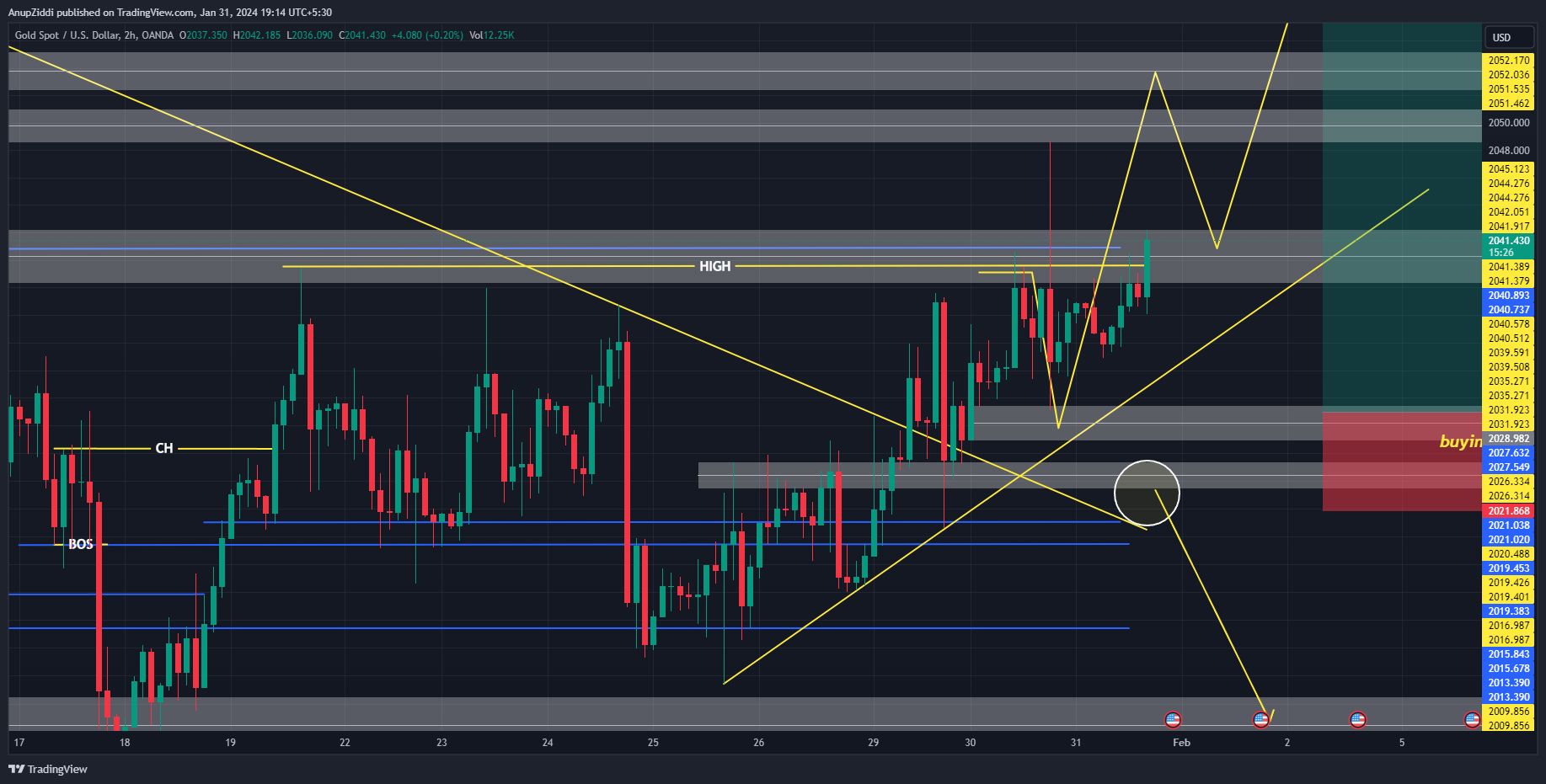 OANDA:XAUUSD Chart Image by AnupZiddi