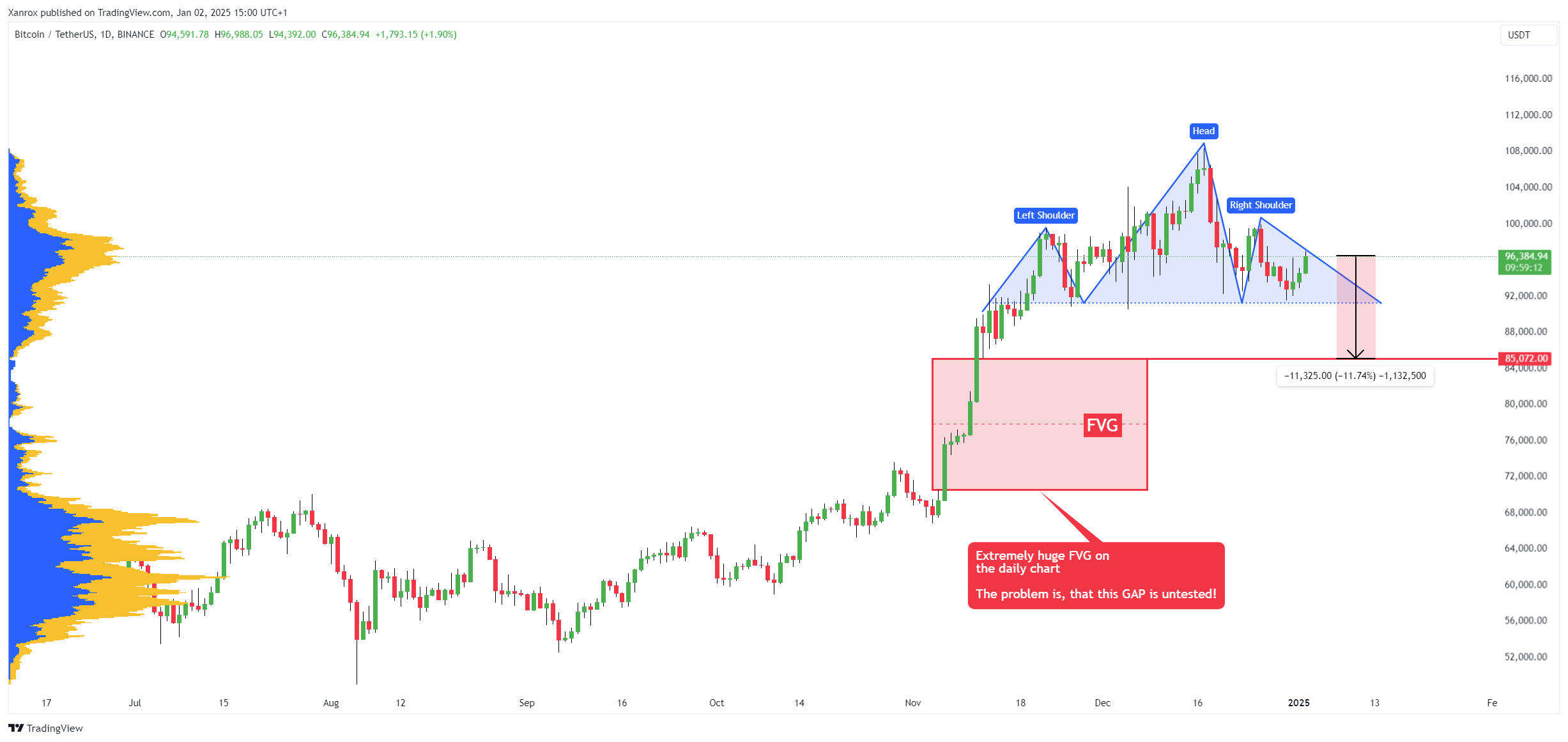 BINANCE:BTCUSDT Chart Image by Xanrox