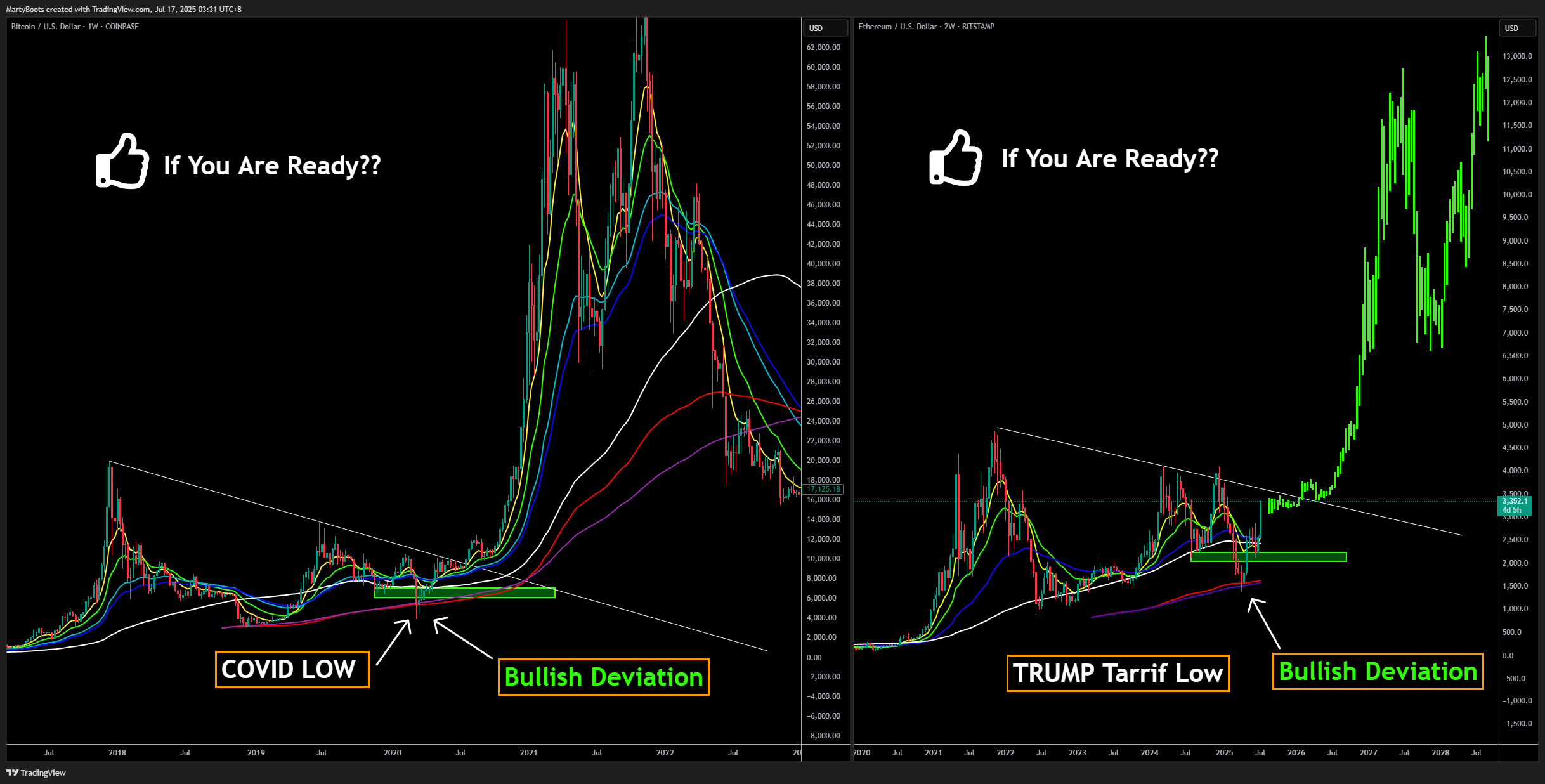 BITSTAMP:ETHUSD Chart Image by MartyBoots