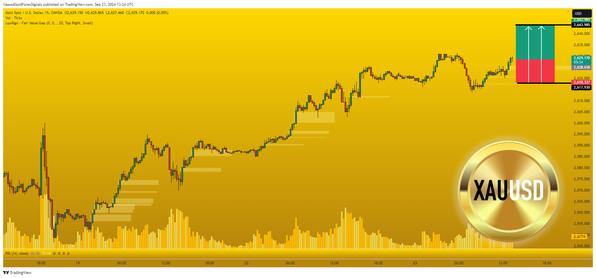 OANDA:XAUUSD Chart Image by XauusdGoldForexSignals