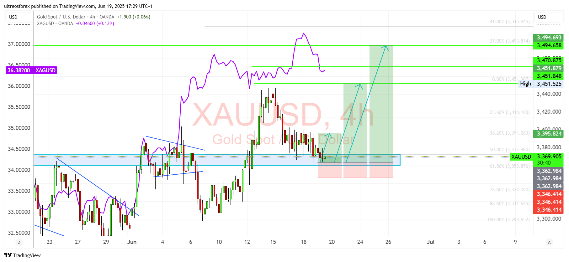 OANDA:XAUUSD Chart Image by ultreosforex