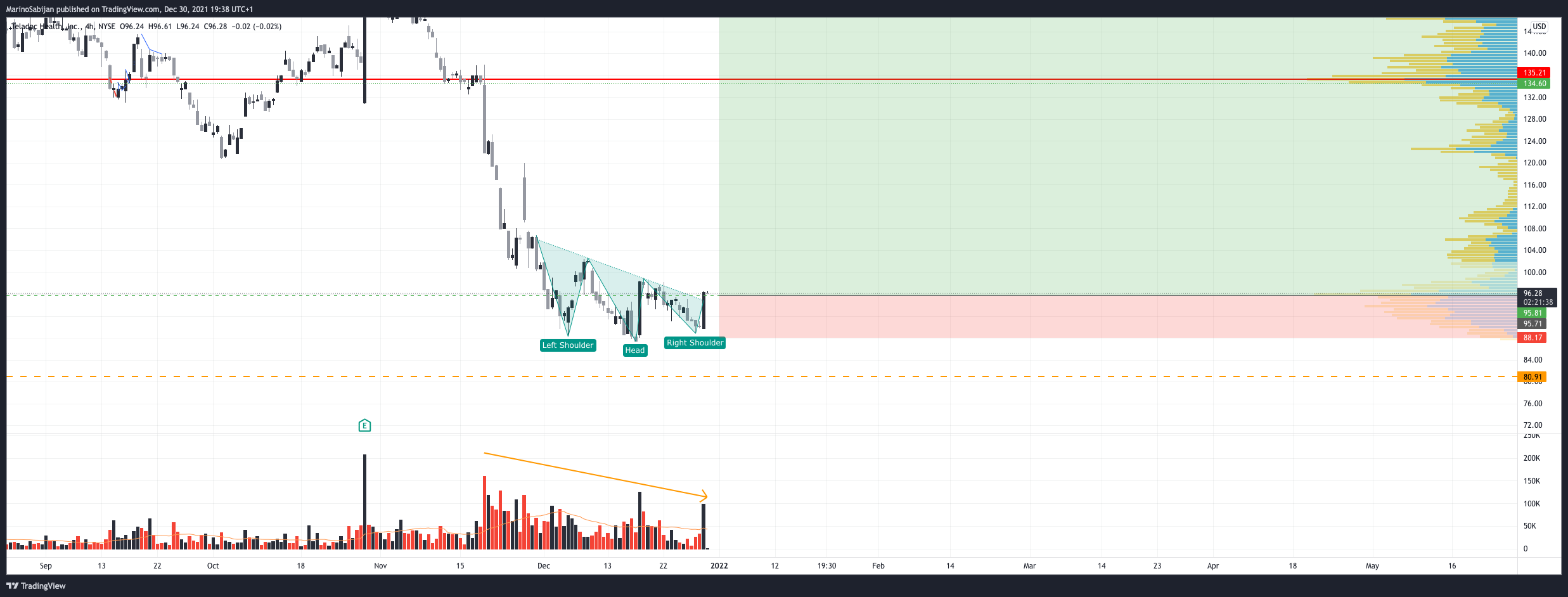 NYSE:TDOC Chart Image by MarinoSabijan