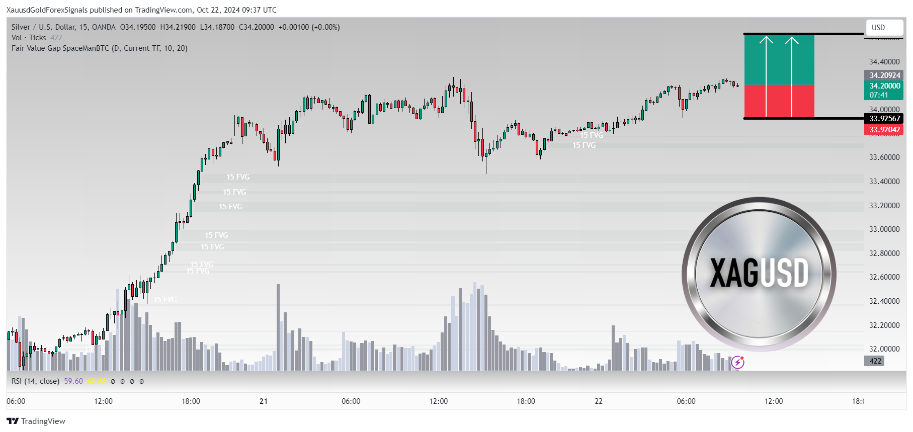 OANDA:XAGUSD Chart Image by XauusdGoldForexSignals