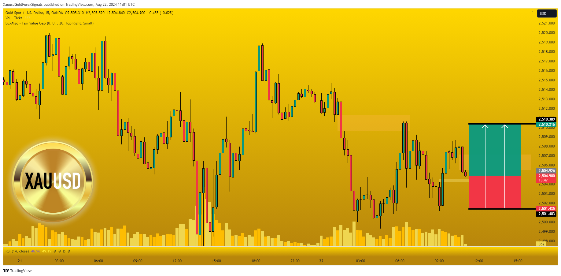 OANDA:XAUUSD Chart Image by XauusdGoldForexSignals