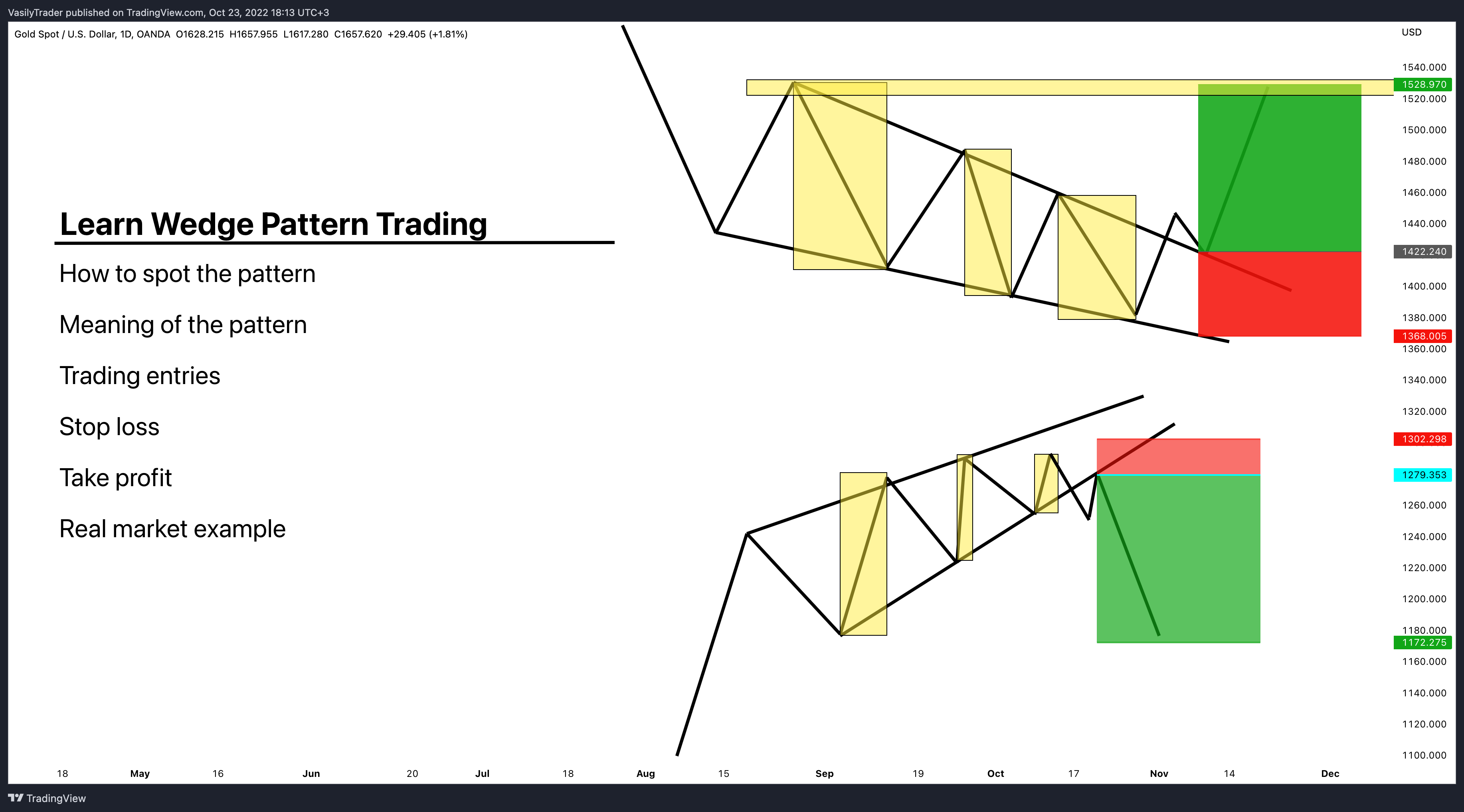 OANDA:XAUUSD Chart Image by VasilyTrader