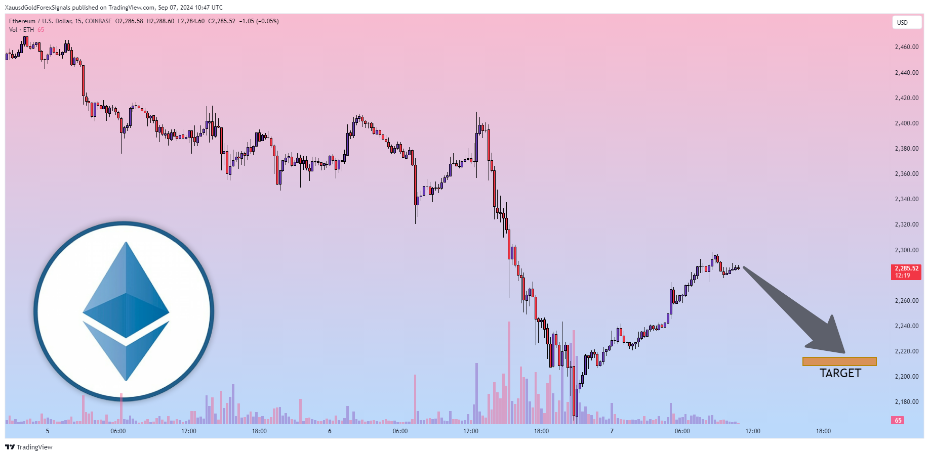 COINBASE:ETHUSD Chart Image by XauusdGoldForexSignals