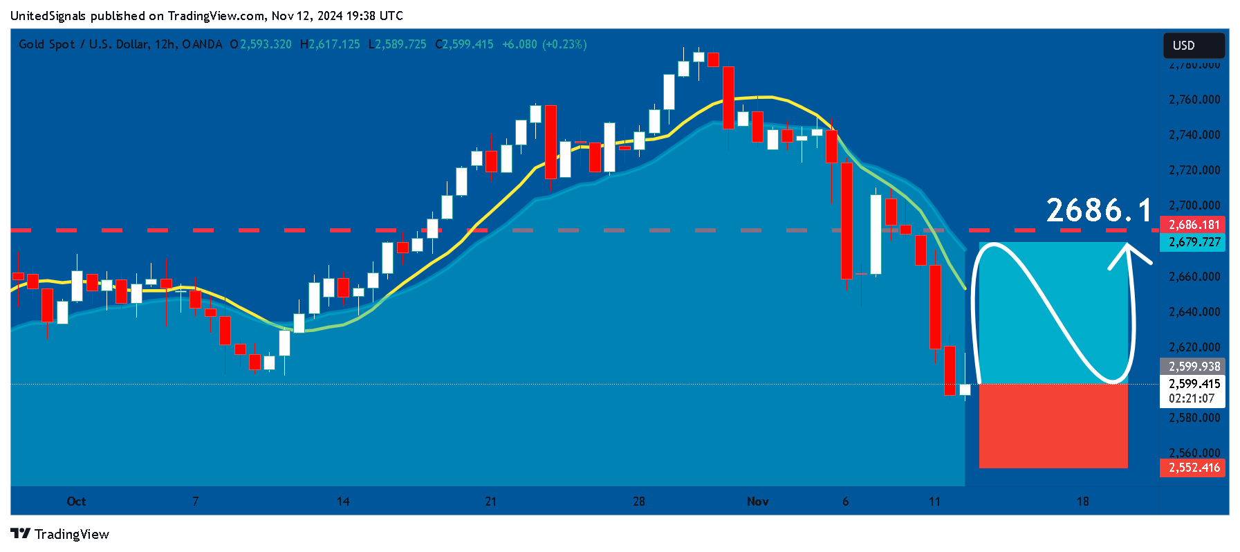 OANDA:XAUUSD Chart Image by UnitedSignals