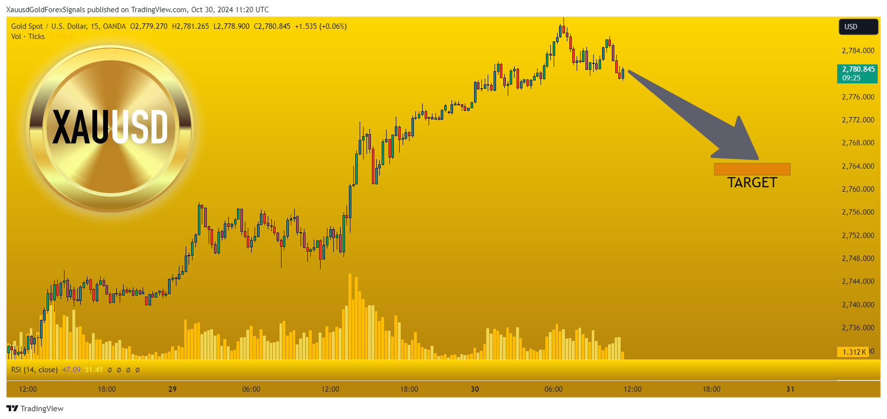 OANDA:XAUUSD Chart Image by XauusdGoldForexSignals