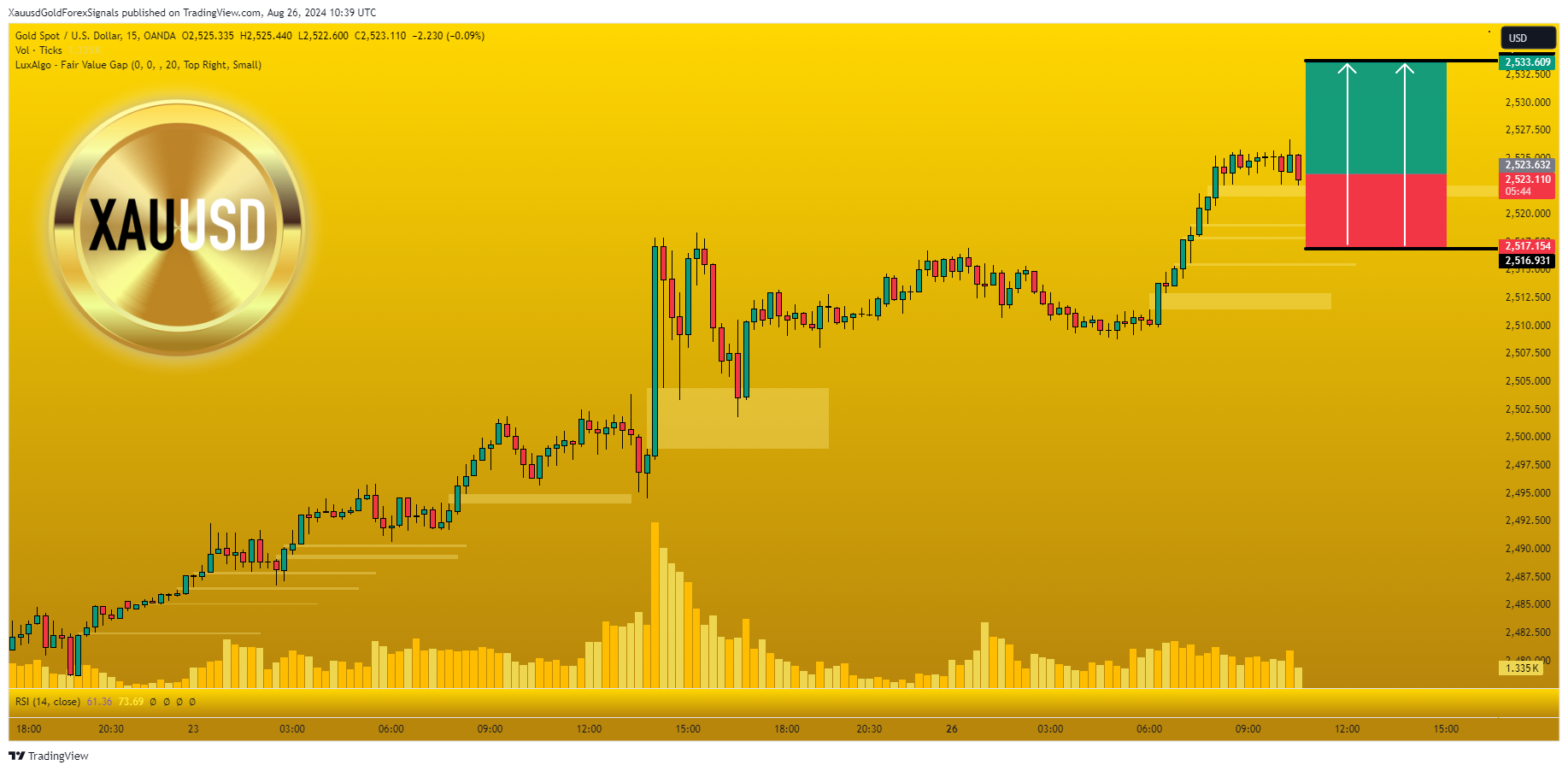 OANDA:XAUUSD Chart Image by XauusdGoldForexSignals