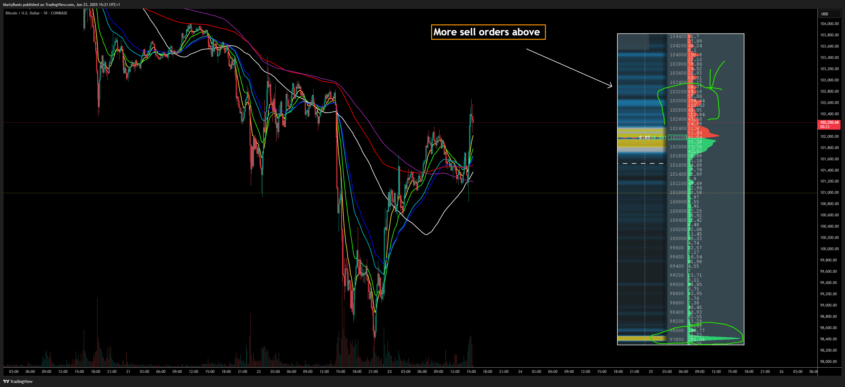 COINBASE:BTCUSD Chart Image by MartyBoots