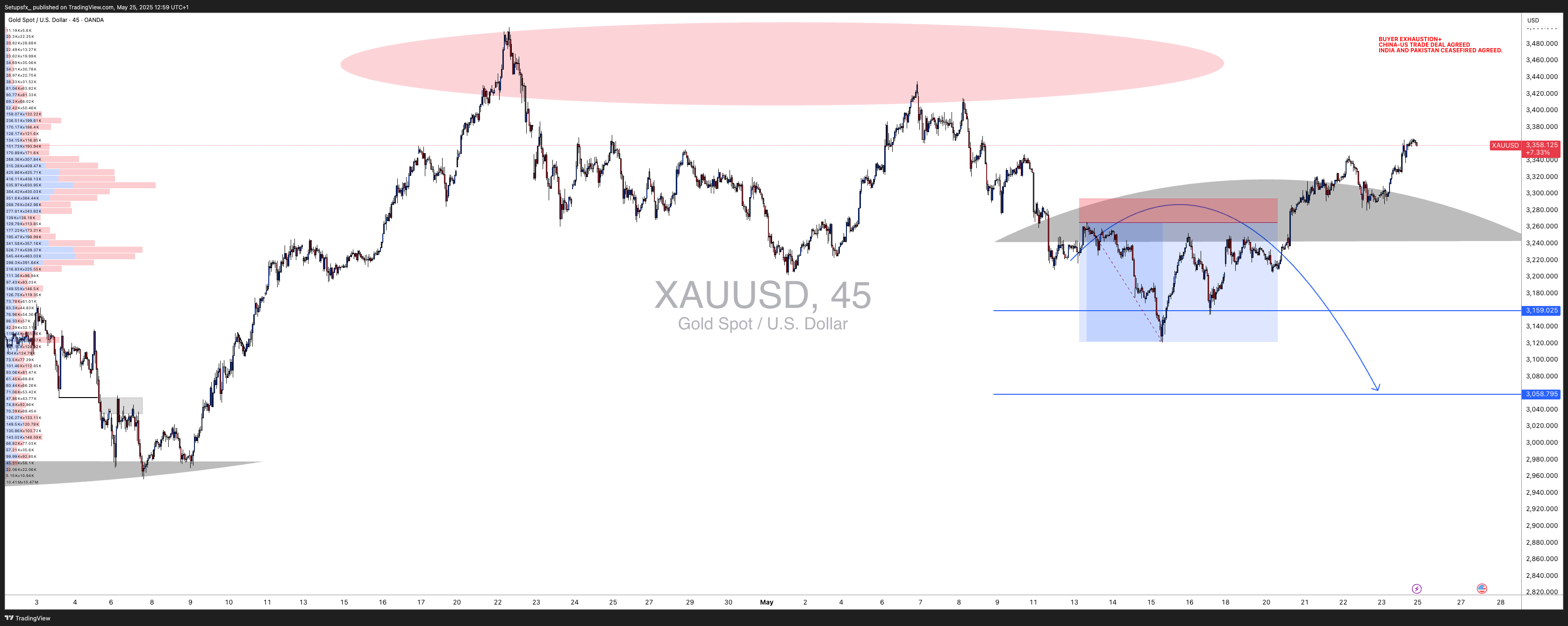 OANDA:XAUUSD Chart Image by Setupsfx_