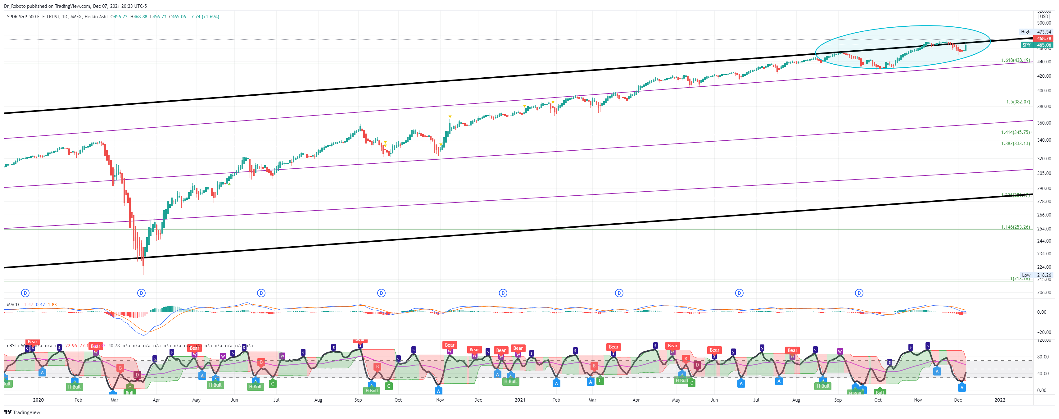 AMEX:SPY Chart Image by Dr_Roboto