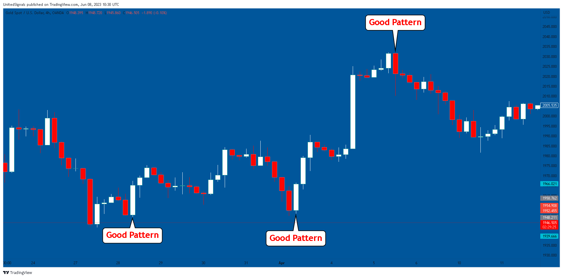 OANDA:XAUUSD Chart Image by UnitedSignals