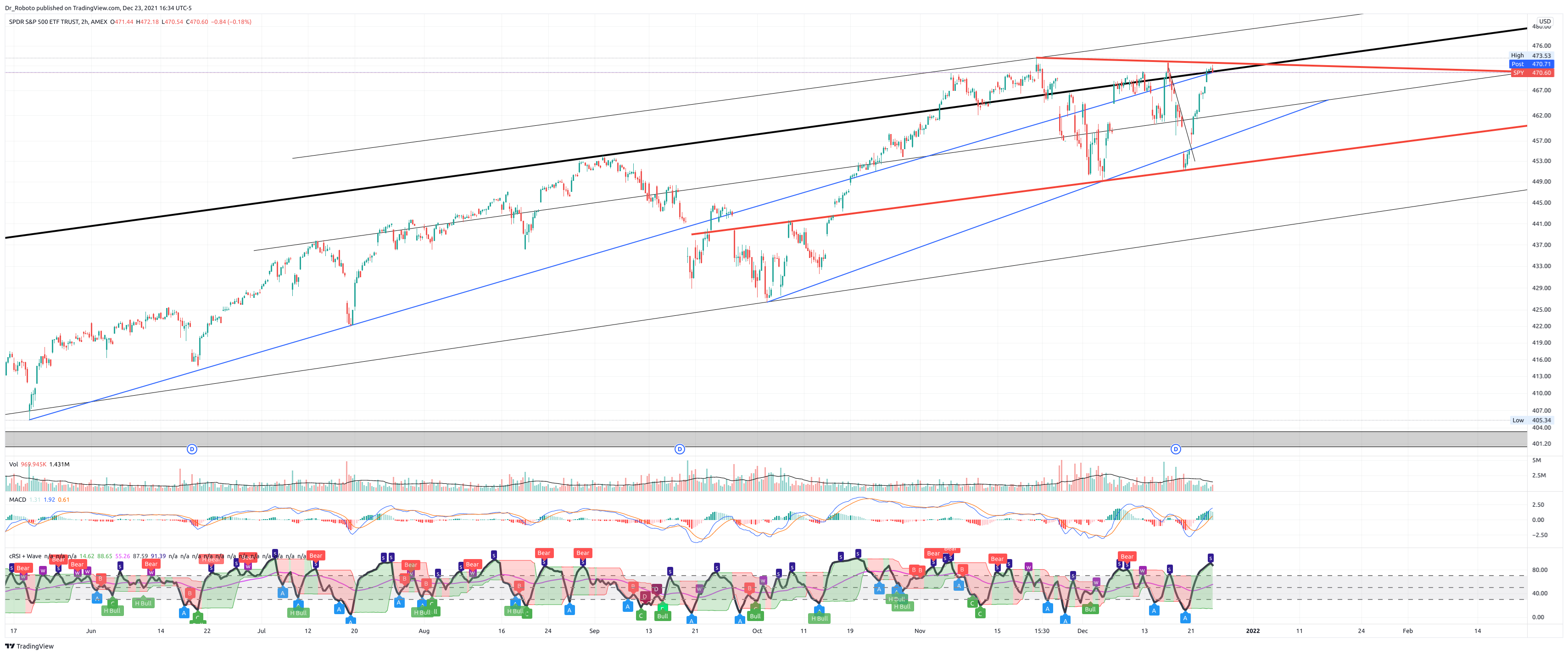 AMEX:SPY Chart Image by Dr_Roboto