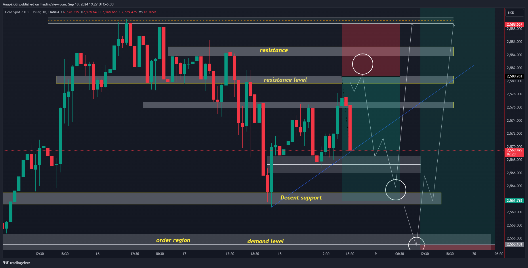 OANDA:XAUUSD Chart Image by AnupZiddi