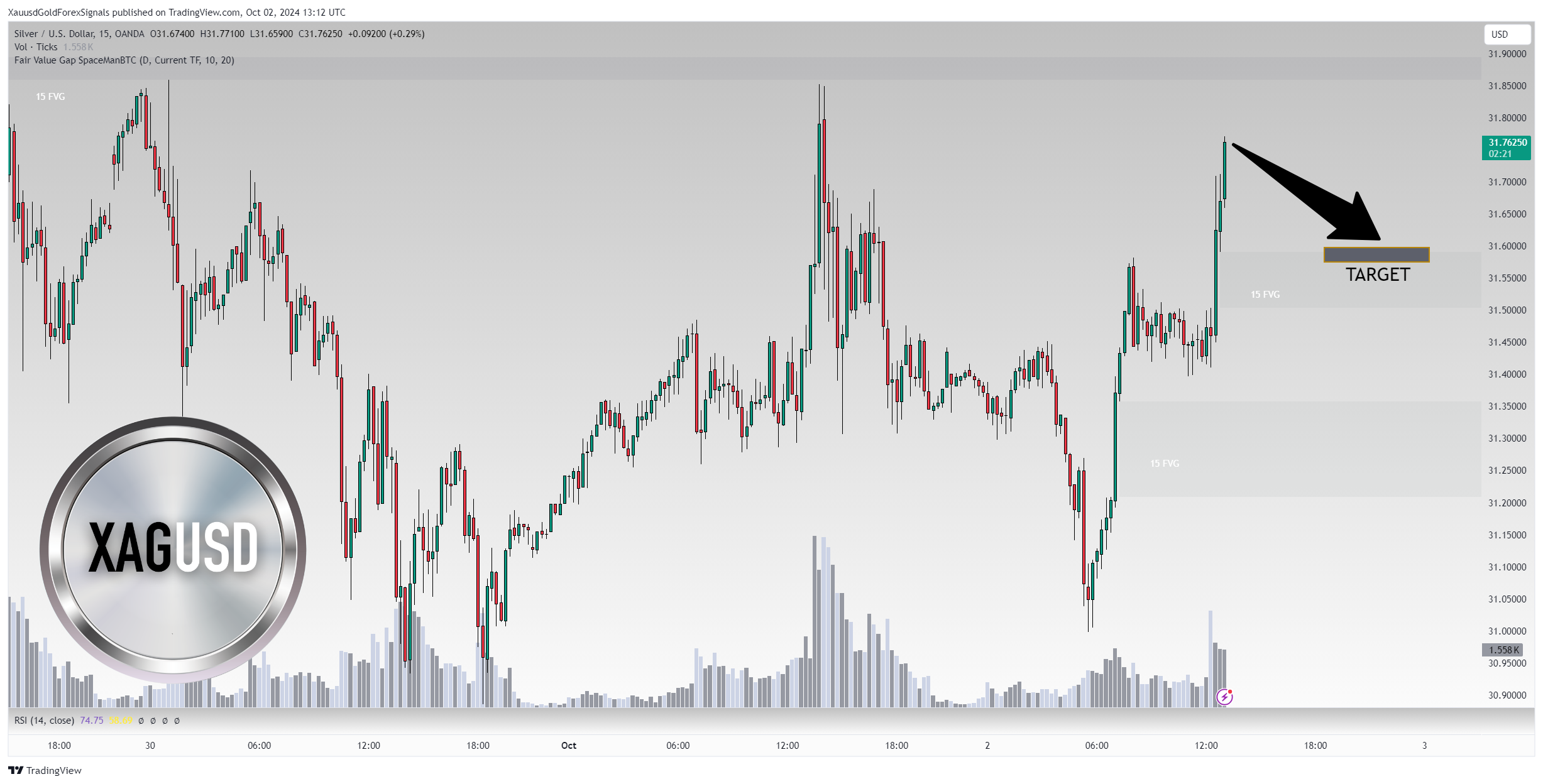 OANDA:XAGUSD Chart Image by XauusdGoldForexSignals