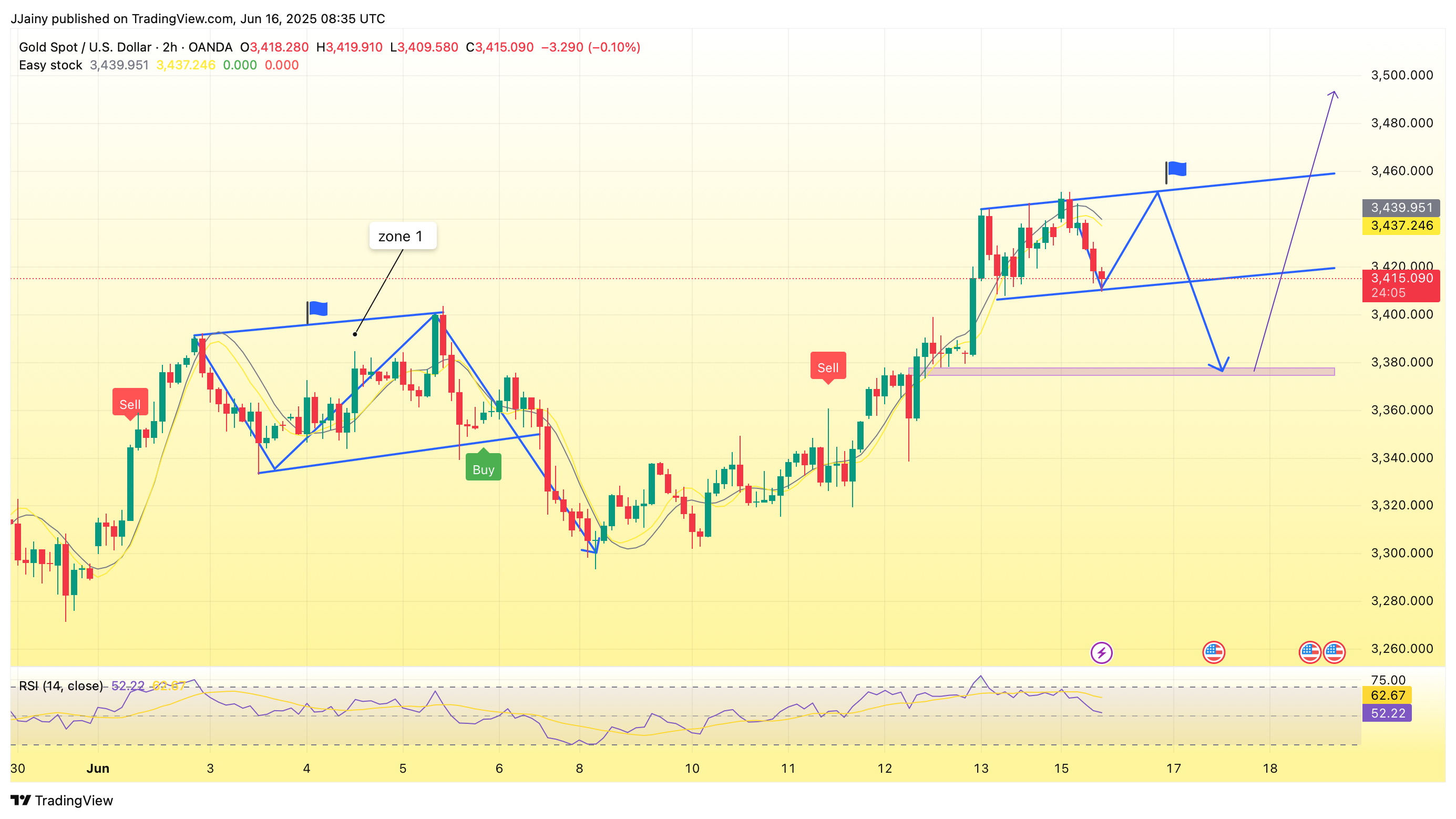 OANDA:XAUUSD Chart Image by JJainy