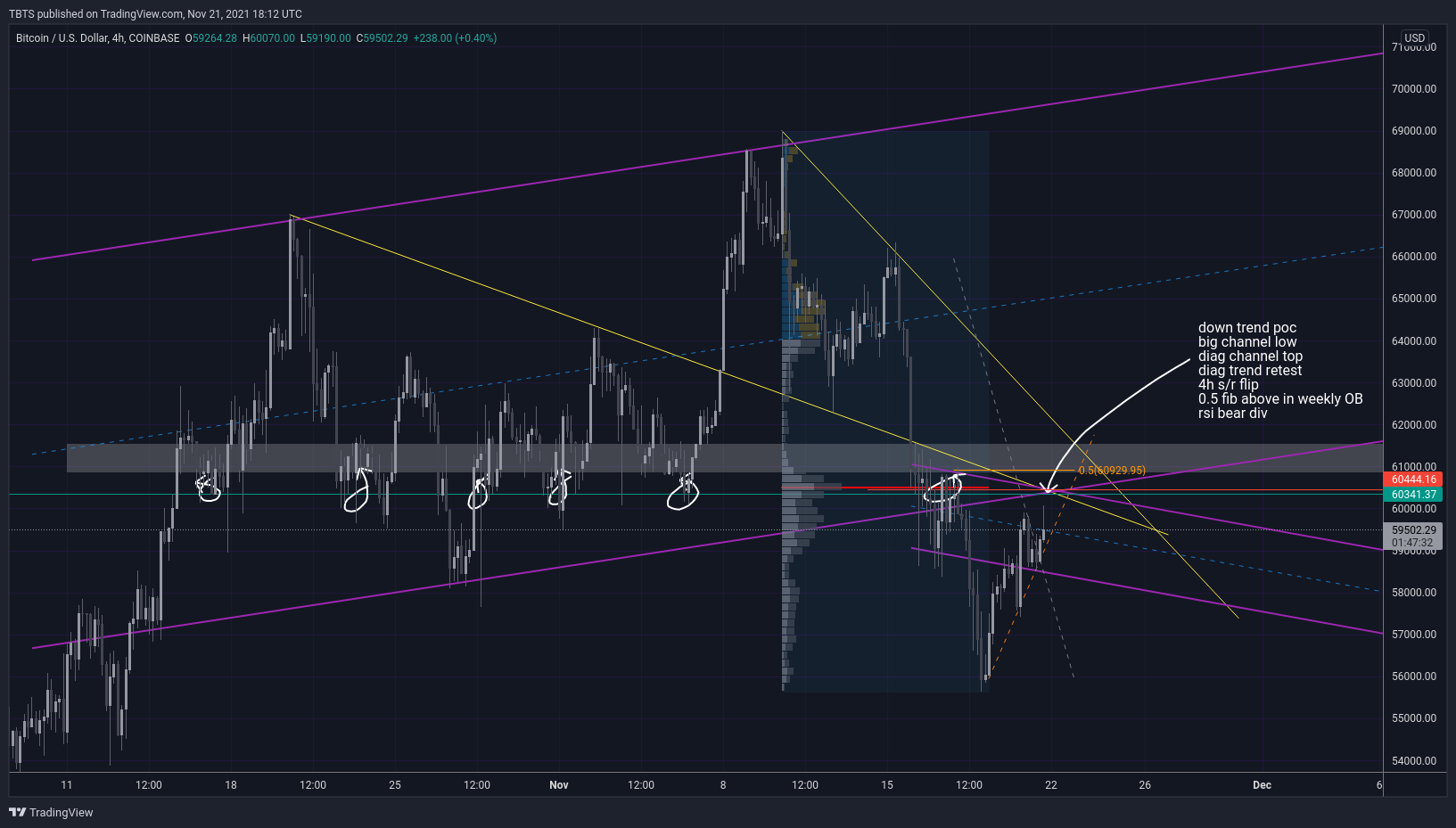 COINBASE:BTCUSD Chart Image by TBTS