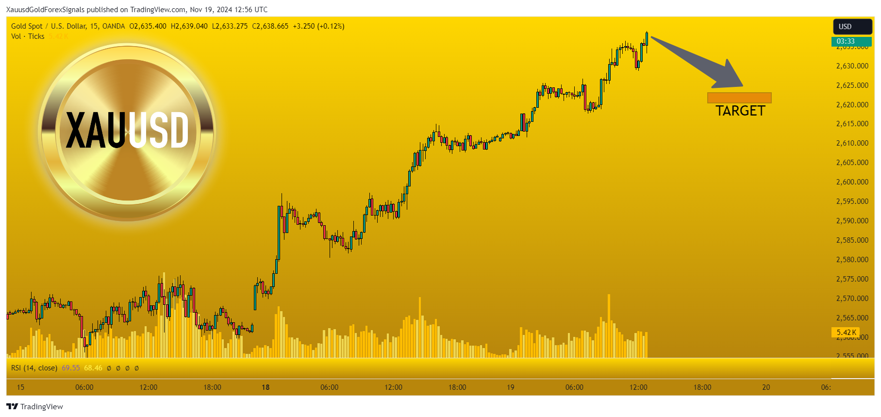 OANDA:XAUUSD Chart Image by XauusdGoldForexSignals