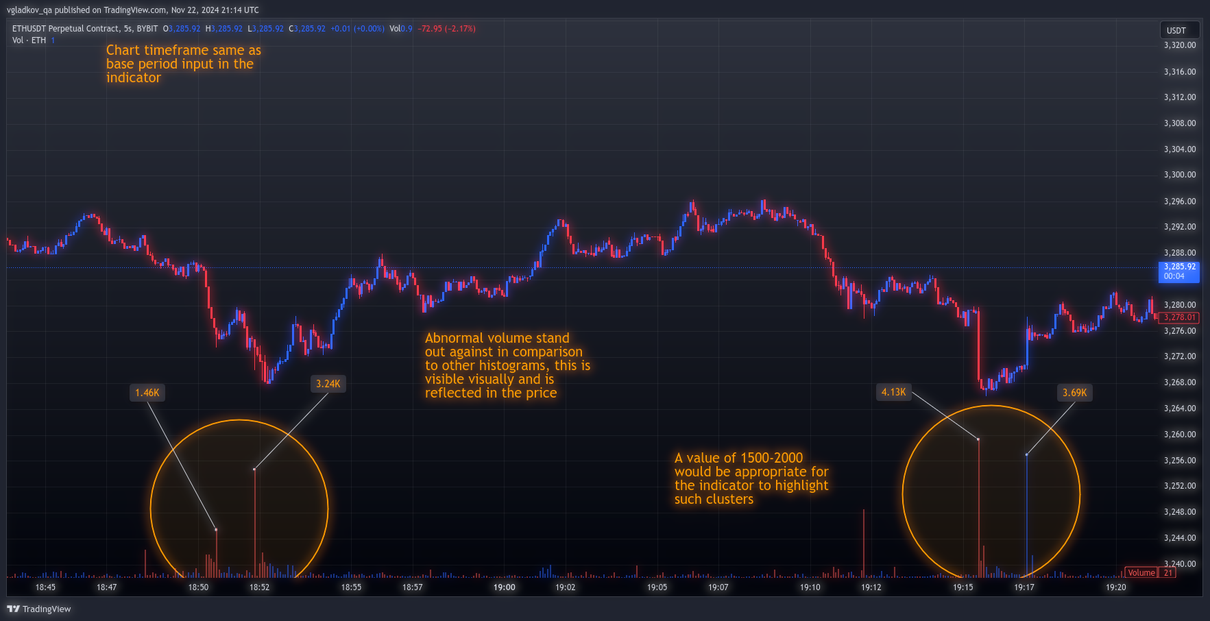 ETHUSDT.P Chart Image by vgladkov_qa