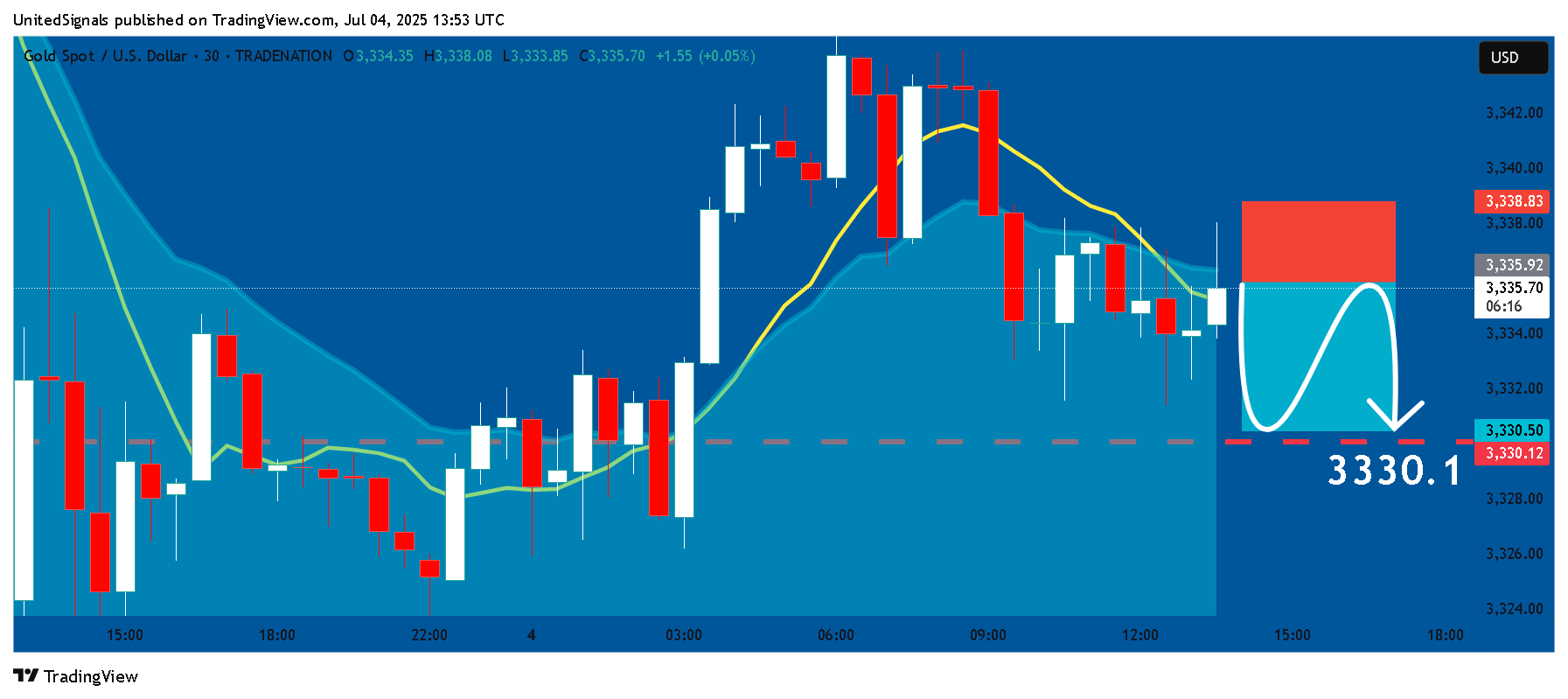 TRADENATION:XAUUSD Chart Image by UnitedSignals