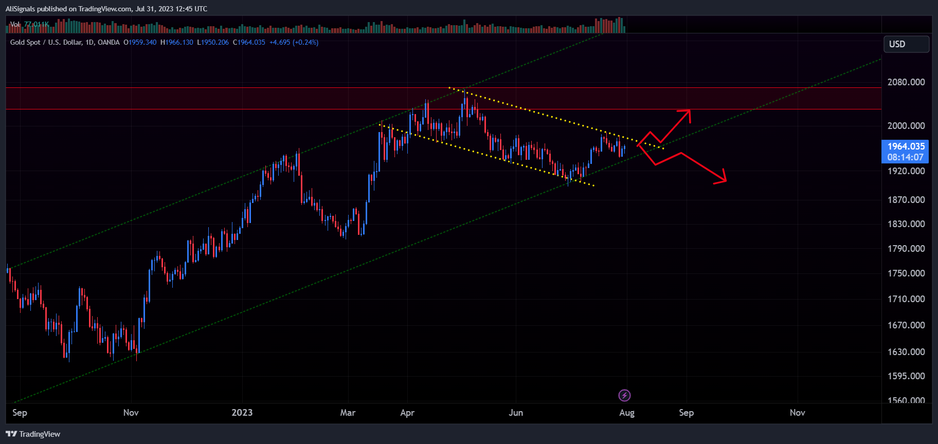 OANDA:XAUUSD Chart Image by AliSignals