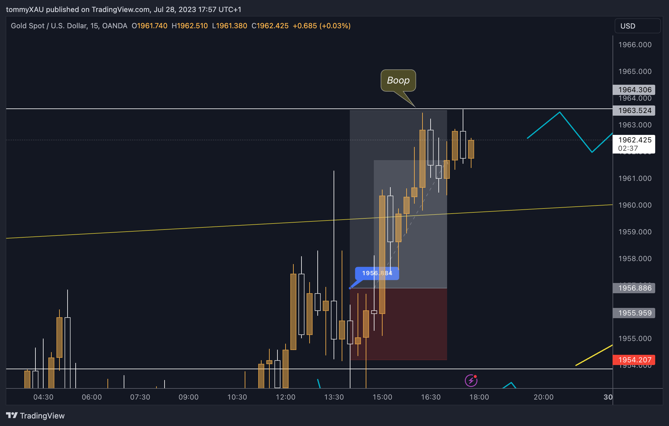 OANDA:XAUUSD Chart Image by tommyXAU