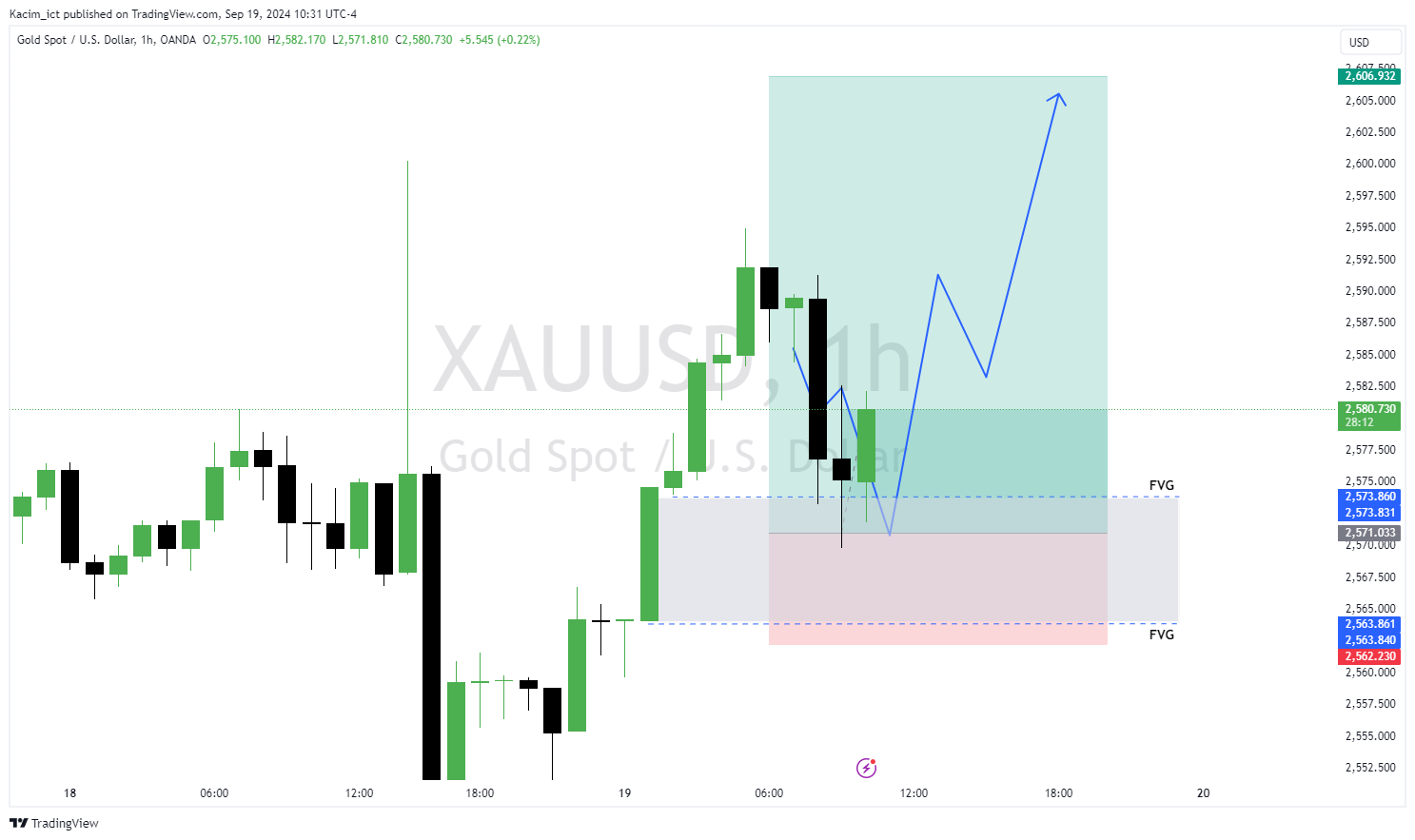 OANDA:XAUUSD Chart Image by Kacim_ict