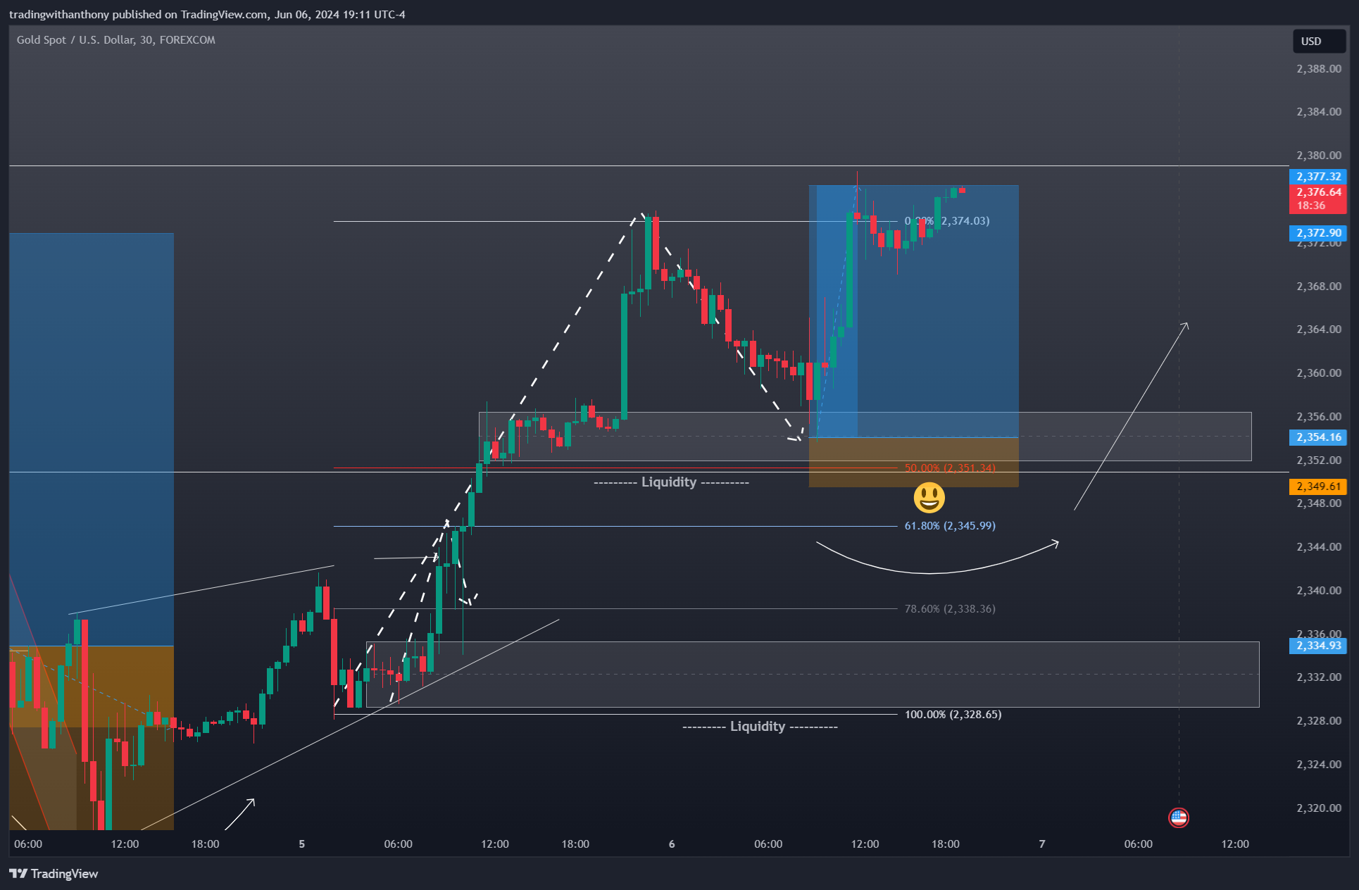 FOREXCOM:XAUUSD Chart Image by fxtraderanthony