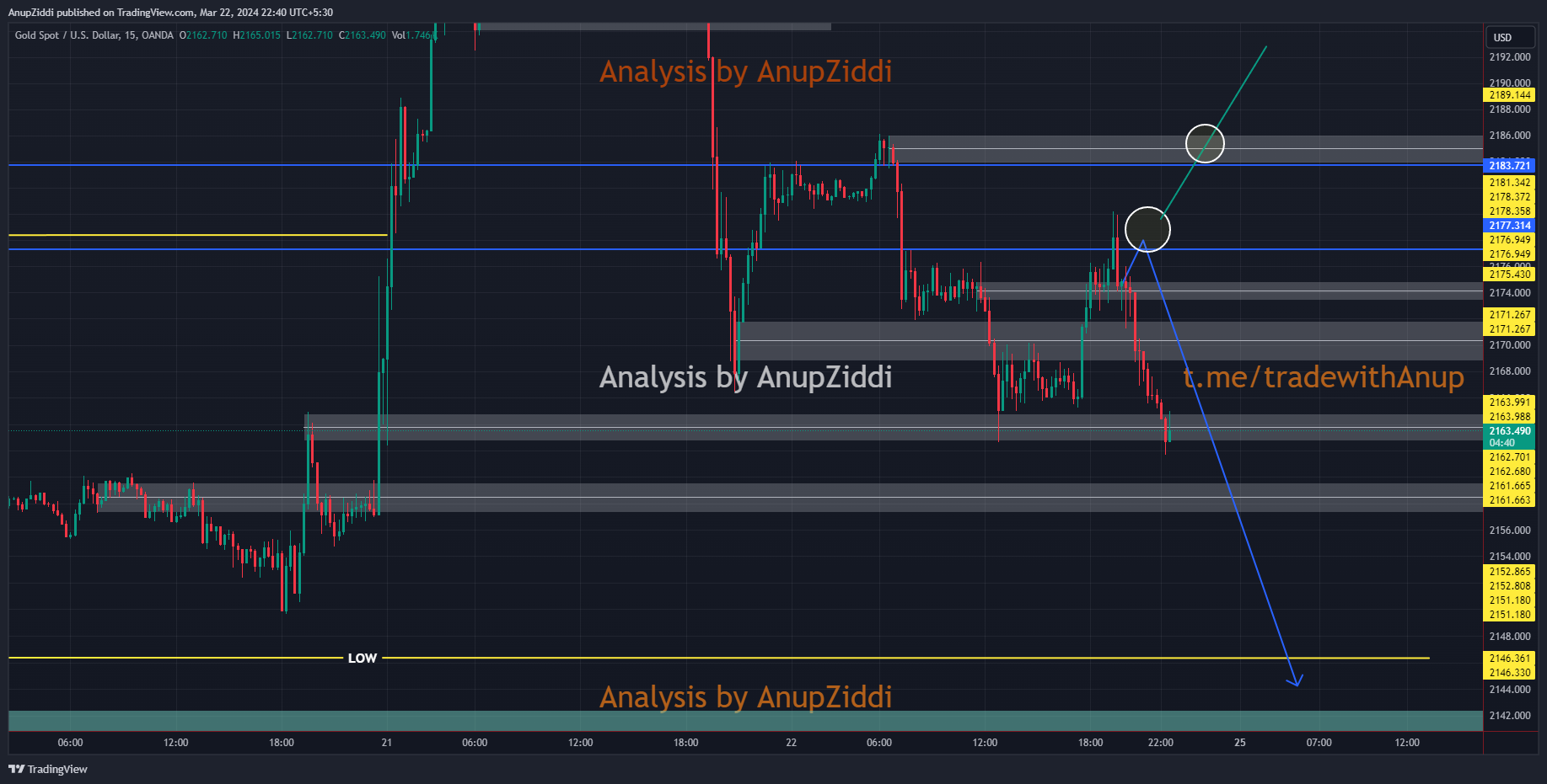 OANDA:XAUUSD Chart Image by AnupZiddi