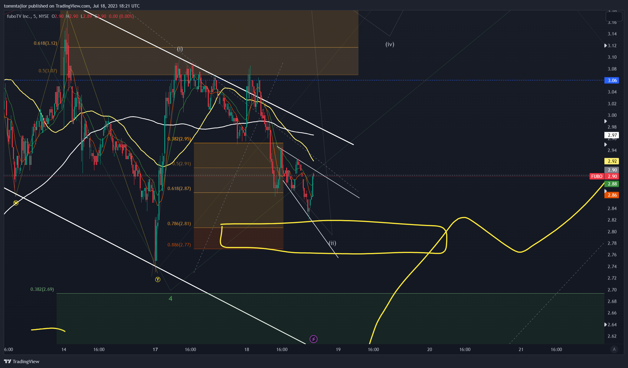 NYSE:FUBO Chart Image by tommtajlor