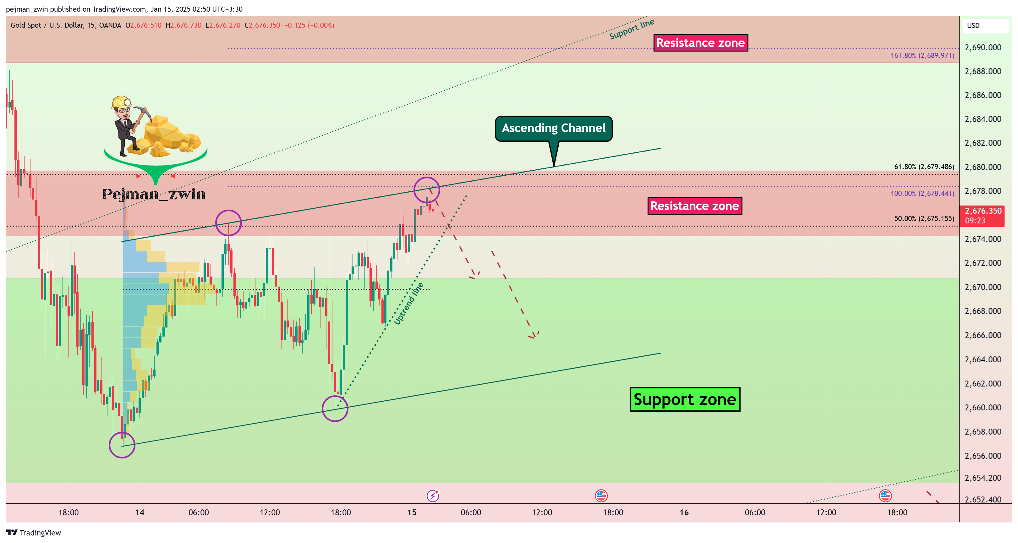 OANDA:XAUUSD Chart Image by pejman_zwin