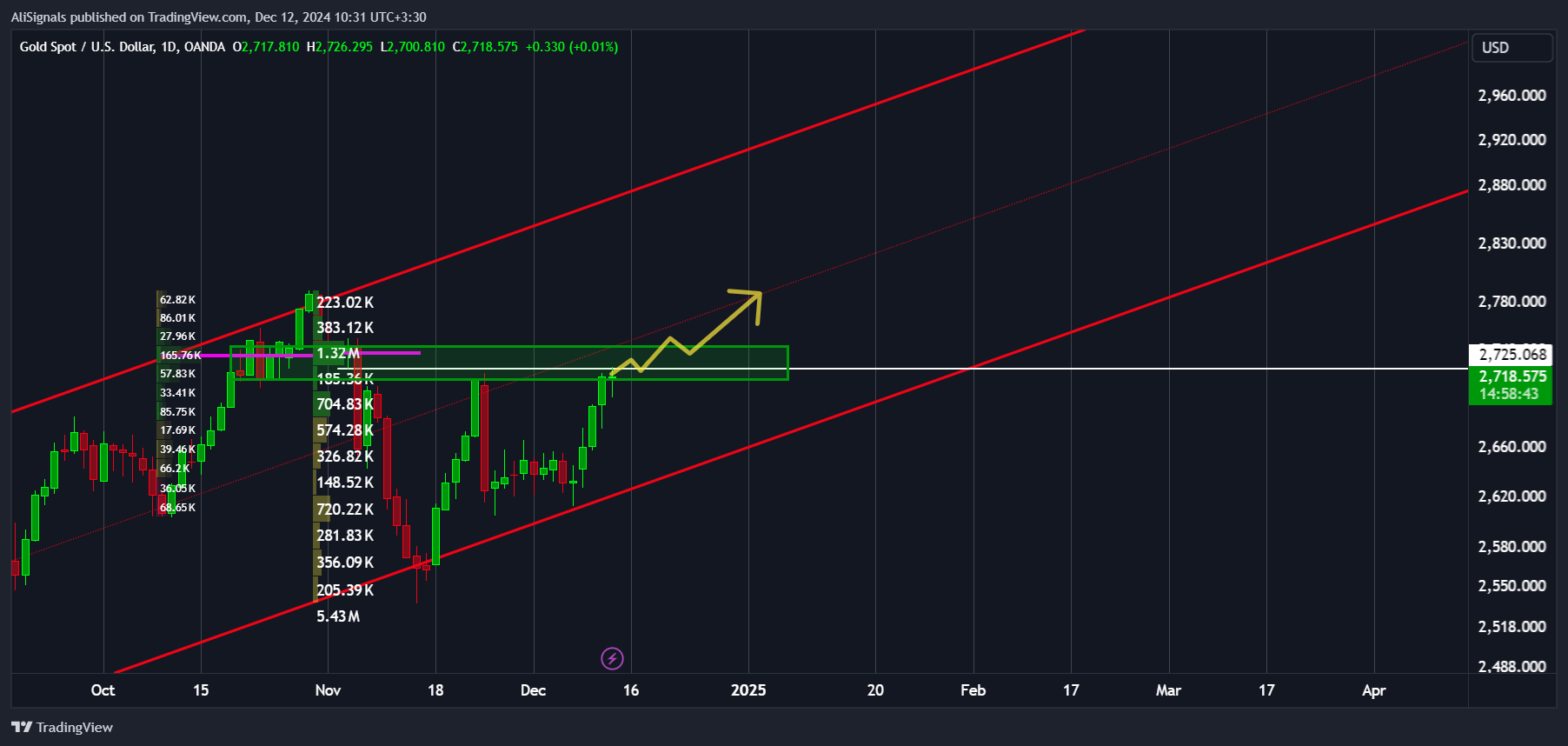 OANDA:XAUUSD Chart Image by AliSignals