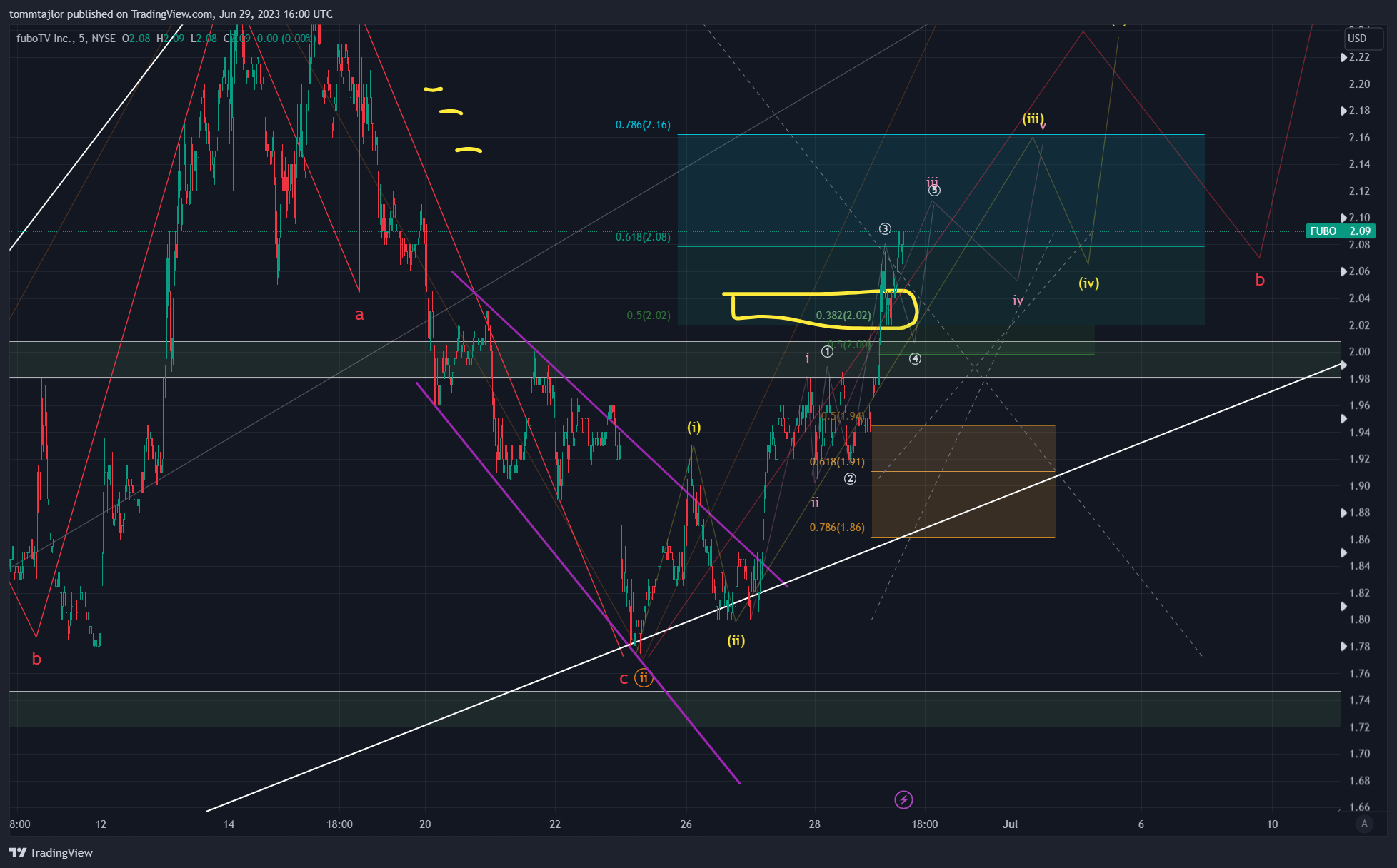 NYSE:FUBO Chart Image by tommtajlor