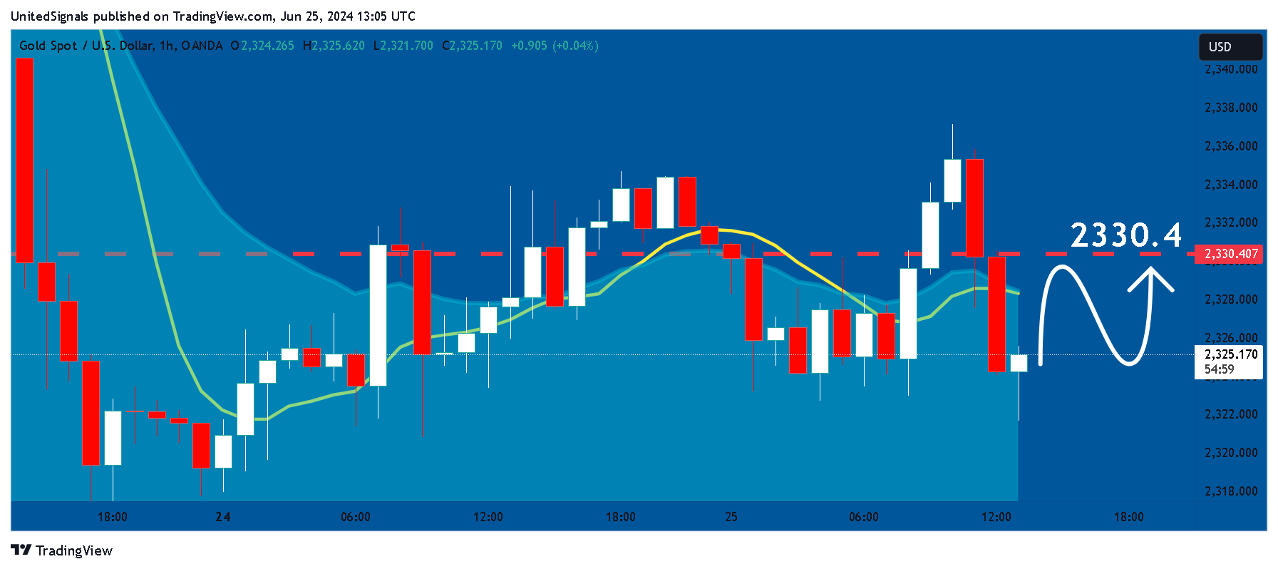 OANDA:XAUUSD Chart Image by UnitedSignals