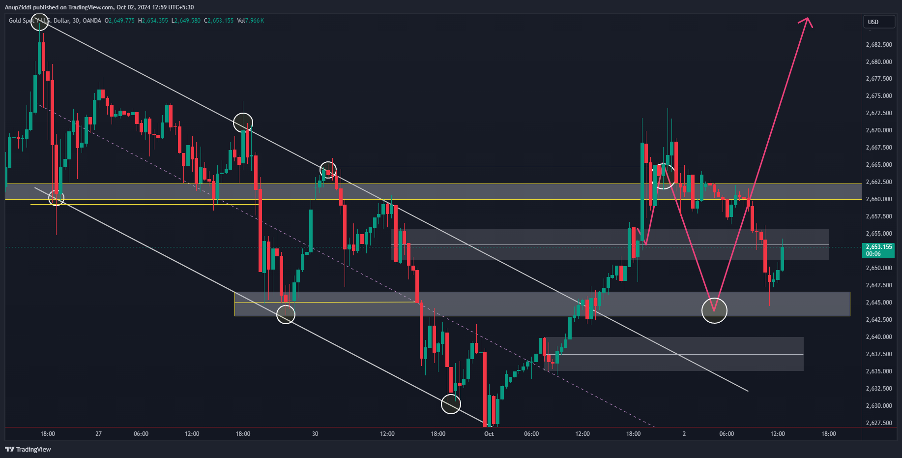 OANDA:XAUUSD Chart Image by AnupZiddi