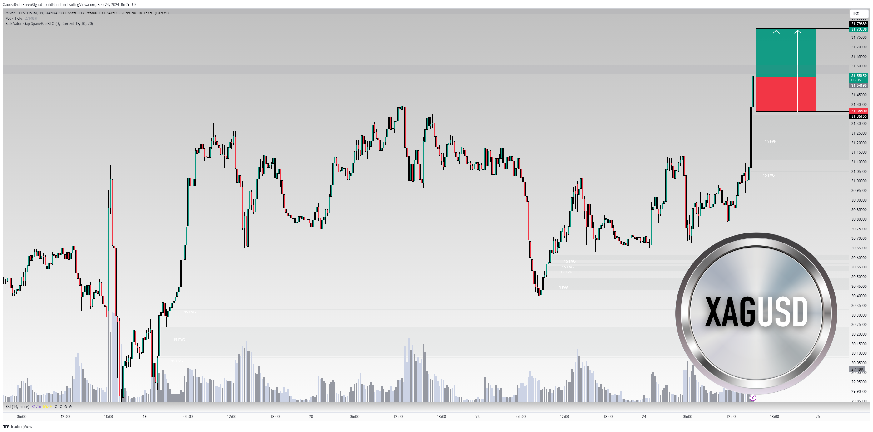 OANDA:XAGUSD Chart Image by XauusdGoldForexSignals