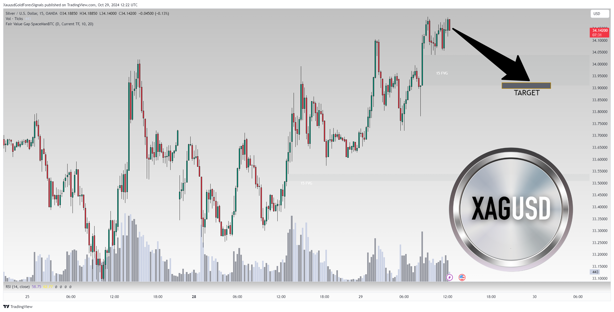 OANDA:XAGUSD Chart Image by XauusdGoldForexSignals