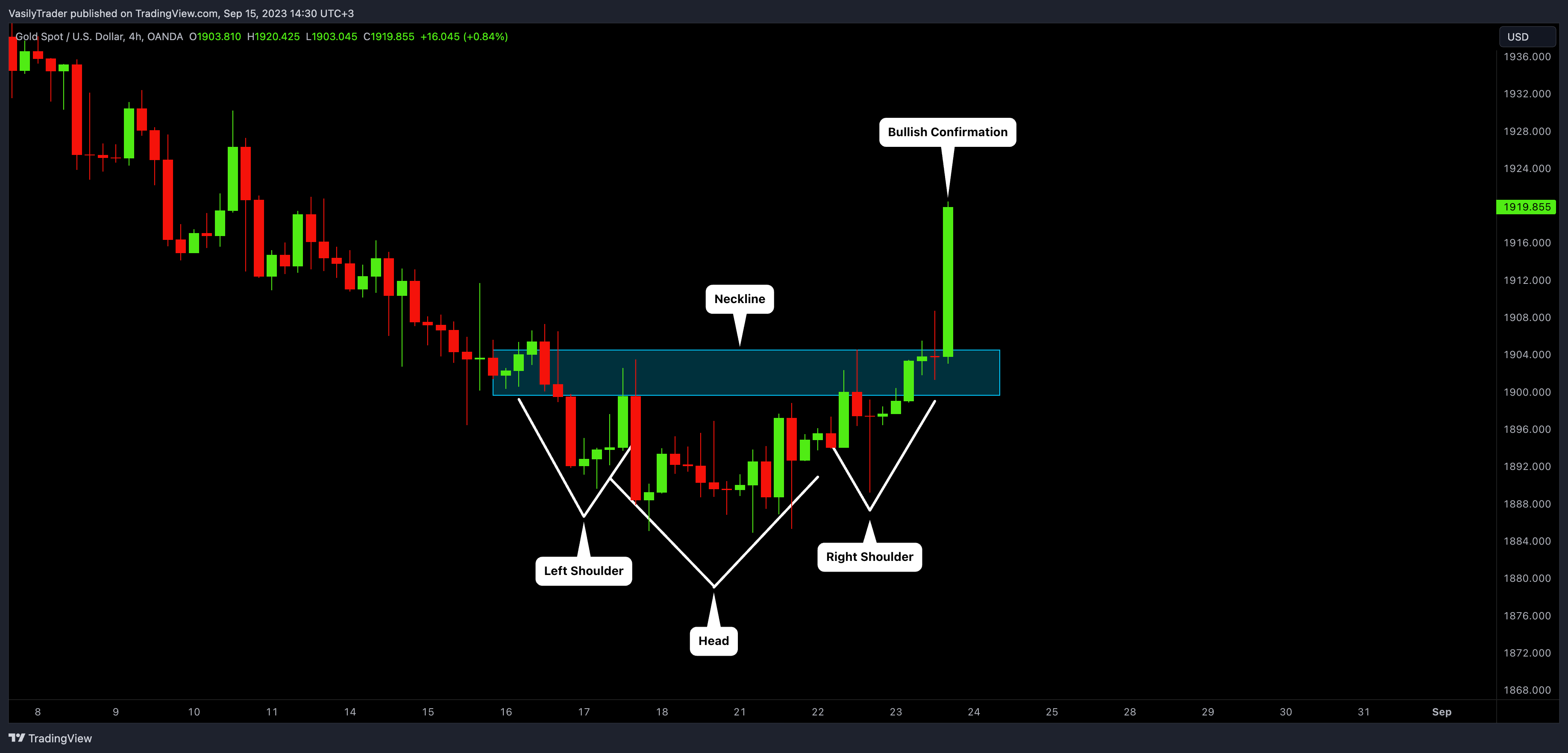 OANDA:XAUUSD Chart Image by VasilyTrader